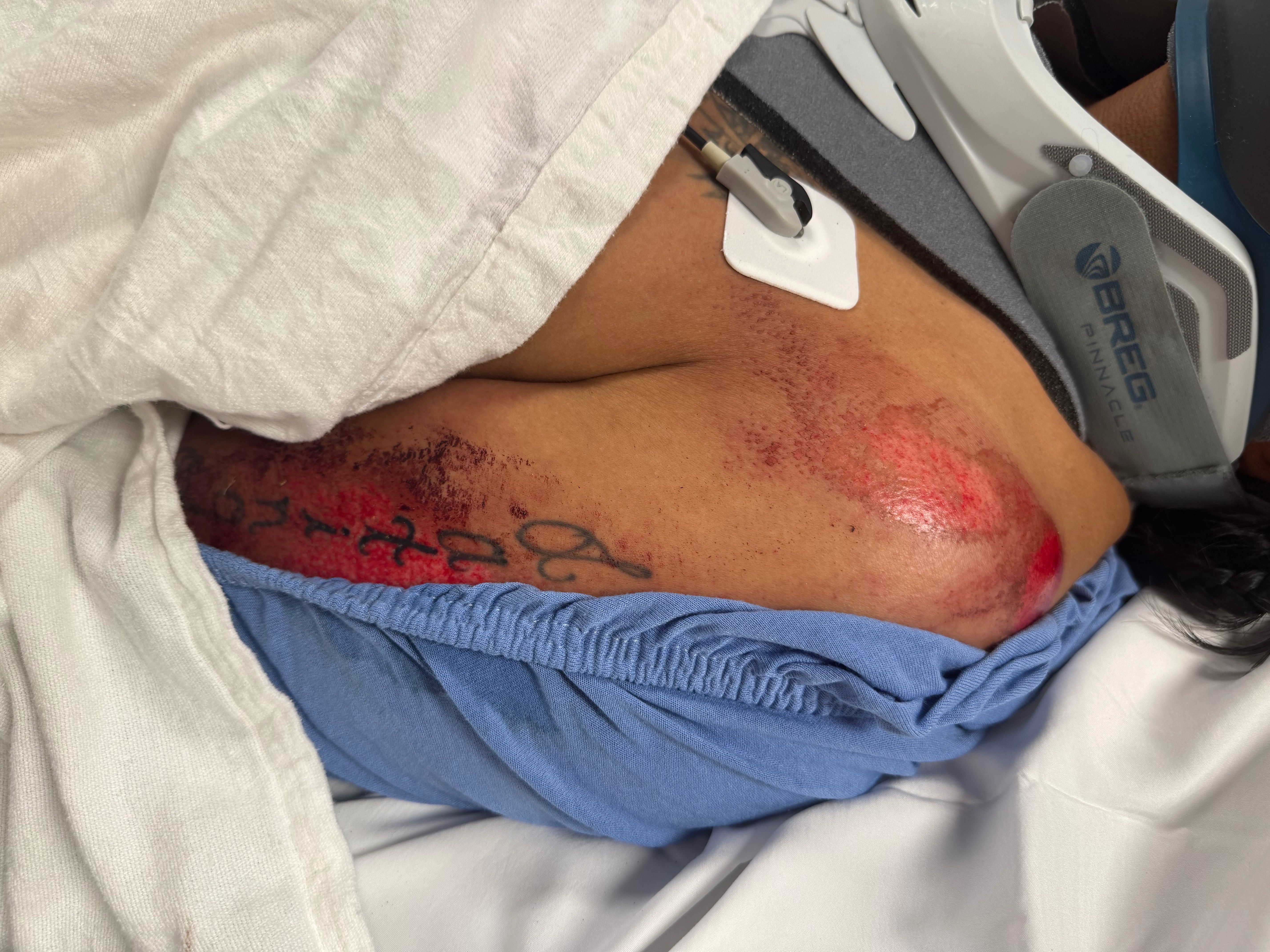 Help support the Luna family post motorcycle accident. campaign photo, 5 of 6