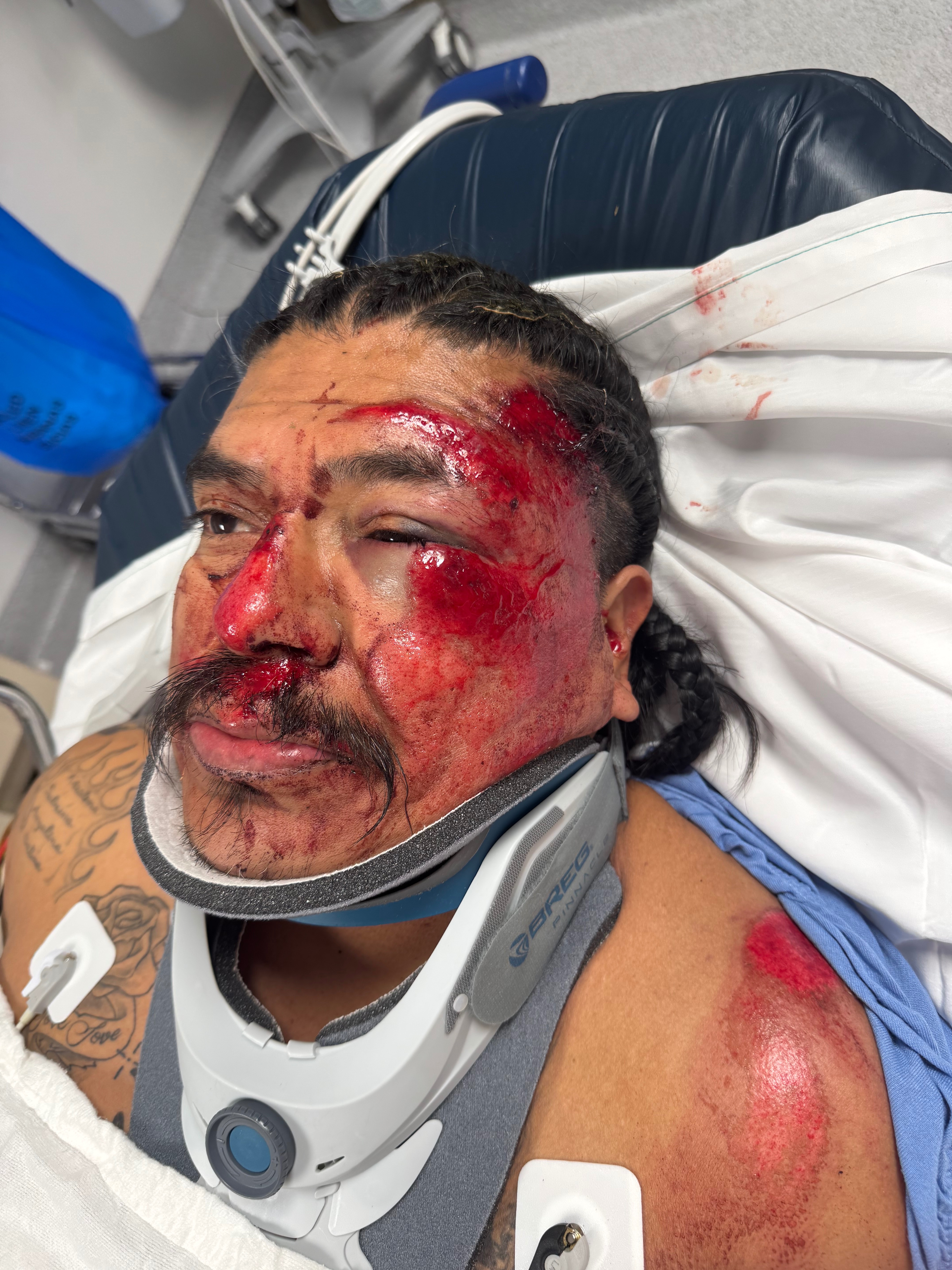Help support the Luna family post motorcycle accident. campaign photo, 4 of 6
