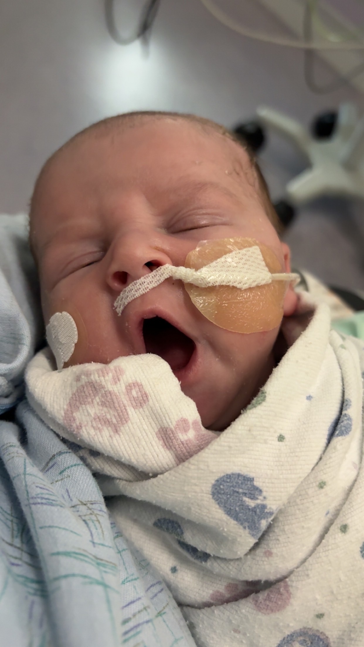 Maddox the baby with only half a heart campaign photo, 2 of 5