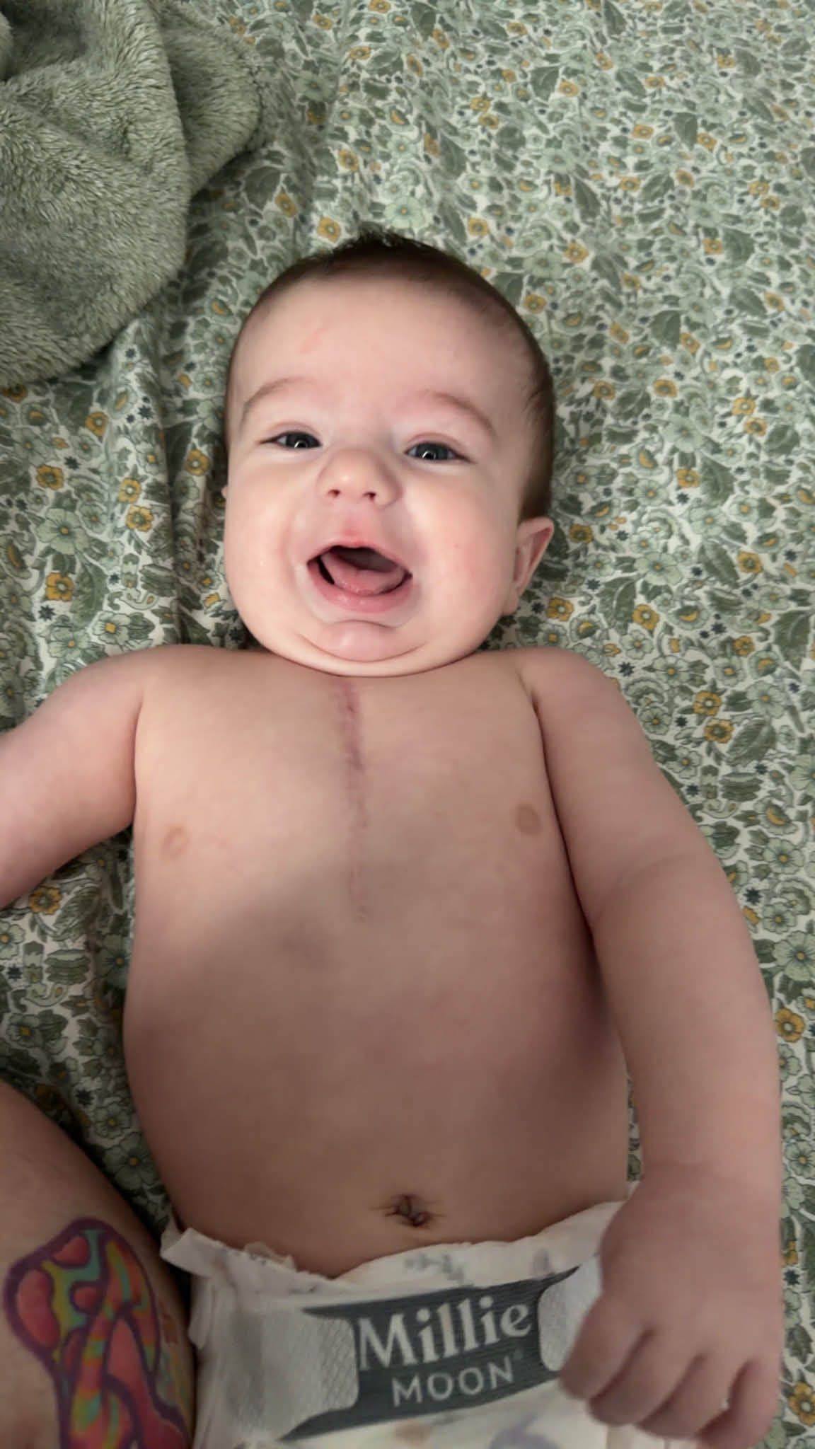 Help Baby Aaron and his family though his next heart surgery campaign photo, 2 of 8