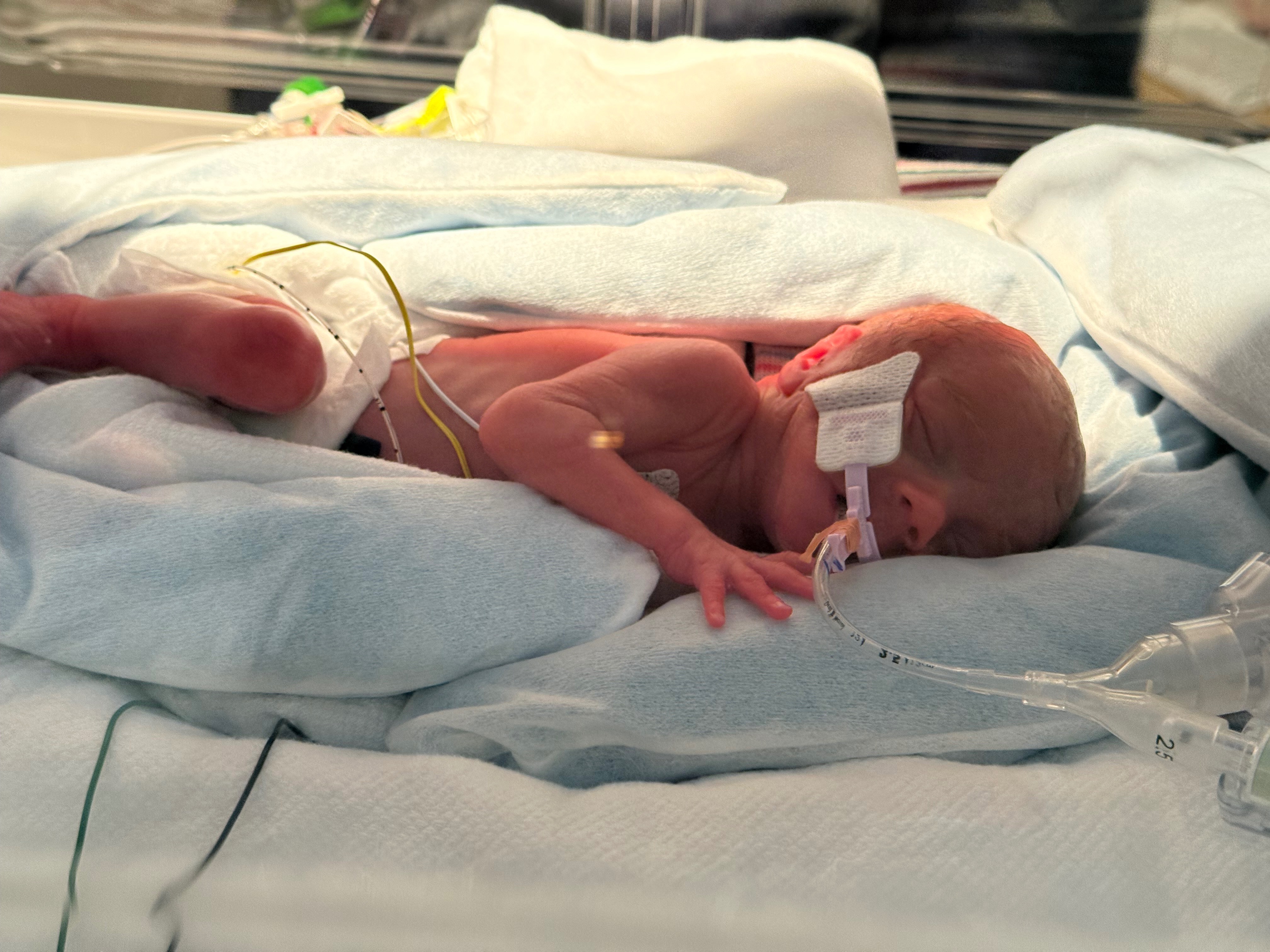 Support Baby Rowyn’s NICU Journey campaign photo, 5 of 6