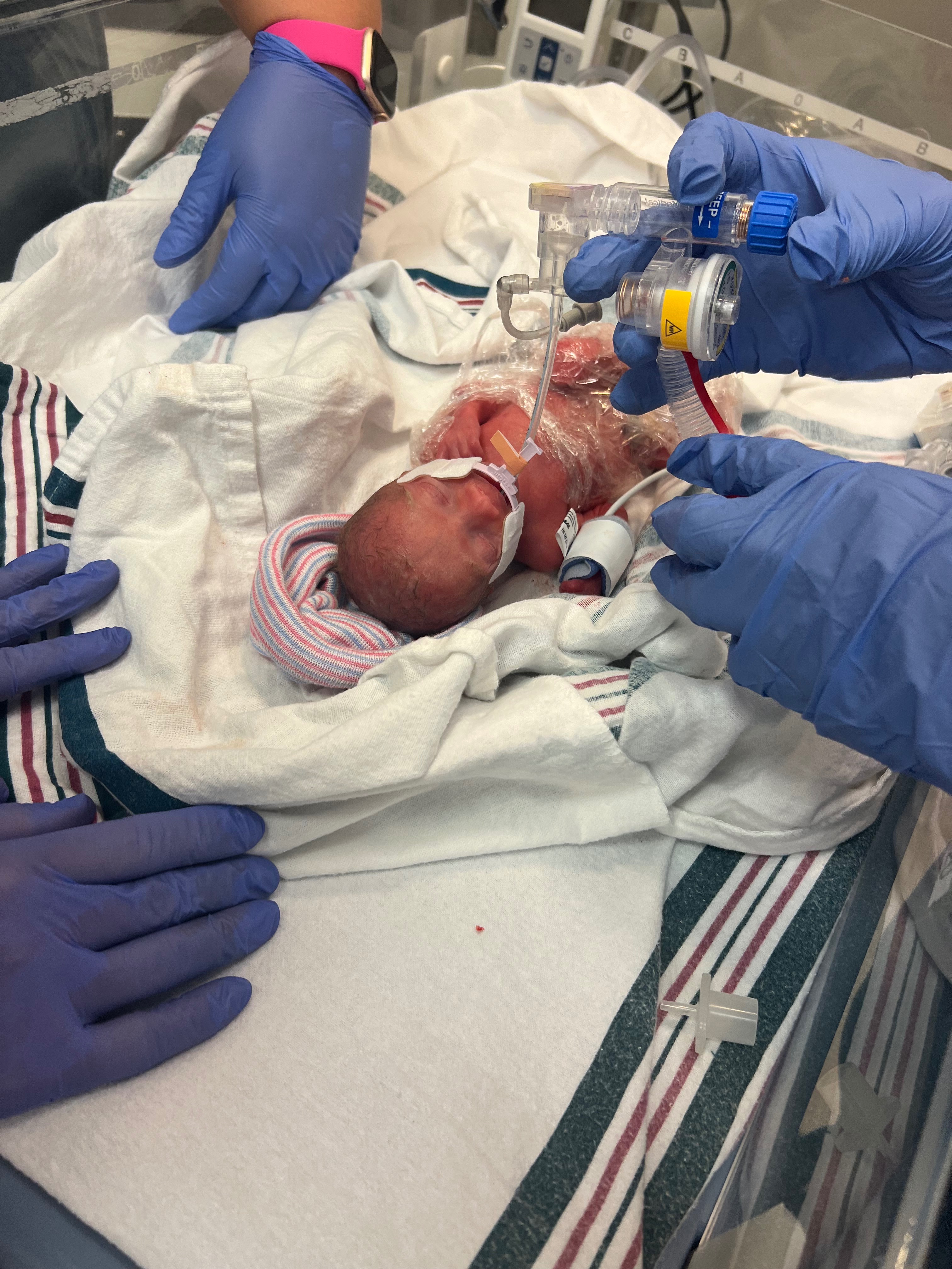 Support Baby Rowyn’s NICU Journey campaign photo, 4 of 6