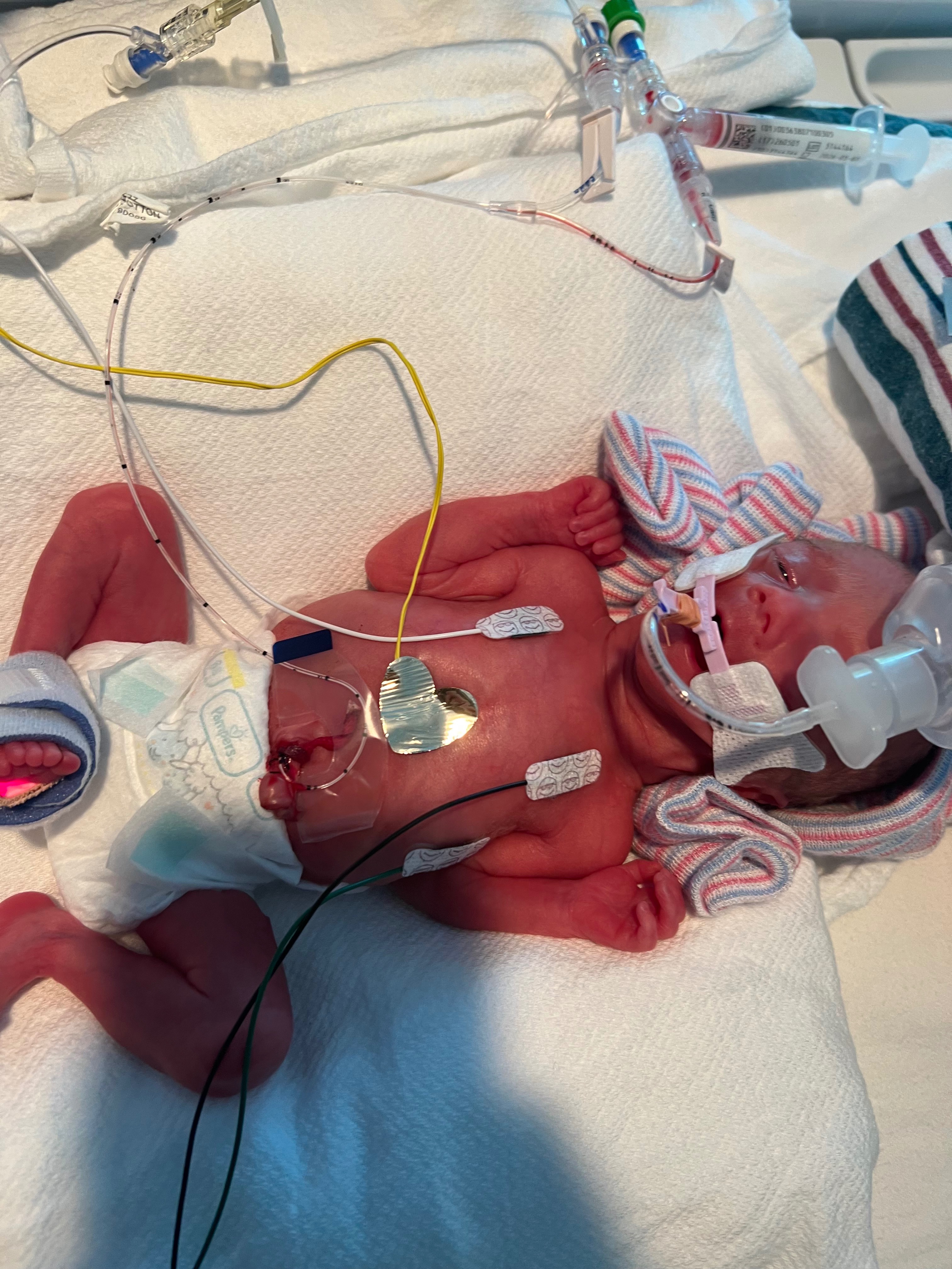 Support Baby Rowyn’s NICU Journey campaign photo, 2 of 6
