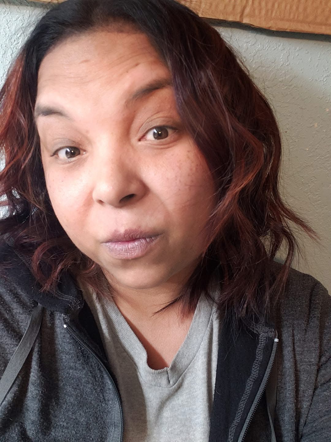 Support Liza Foster's Recovery Journey campaign photo, 4 of 8