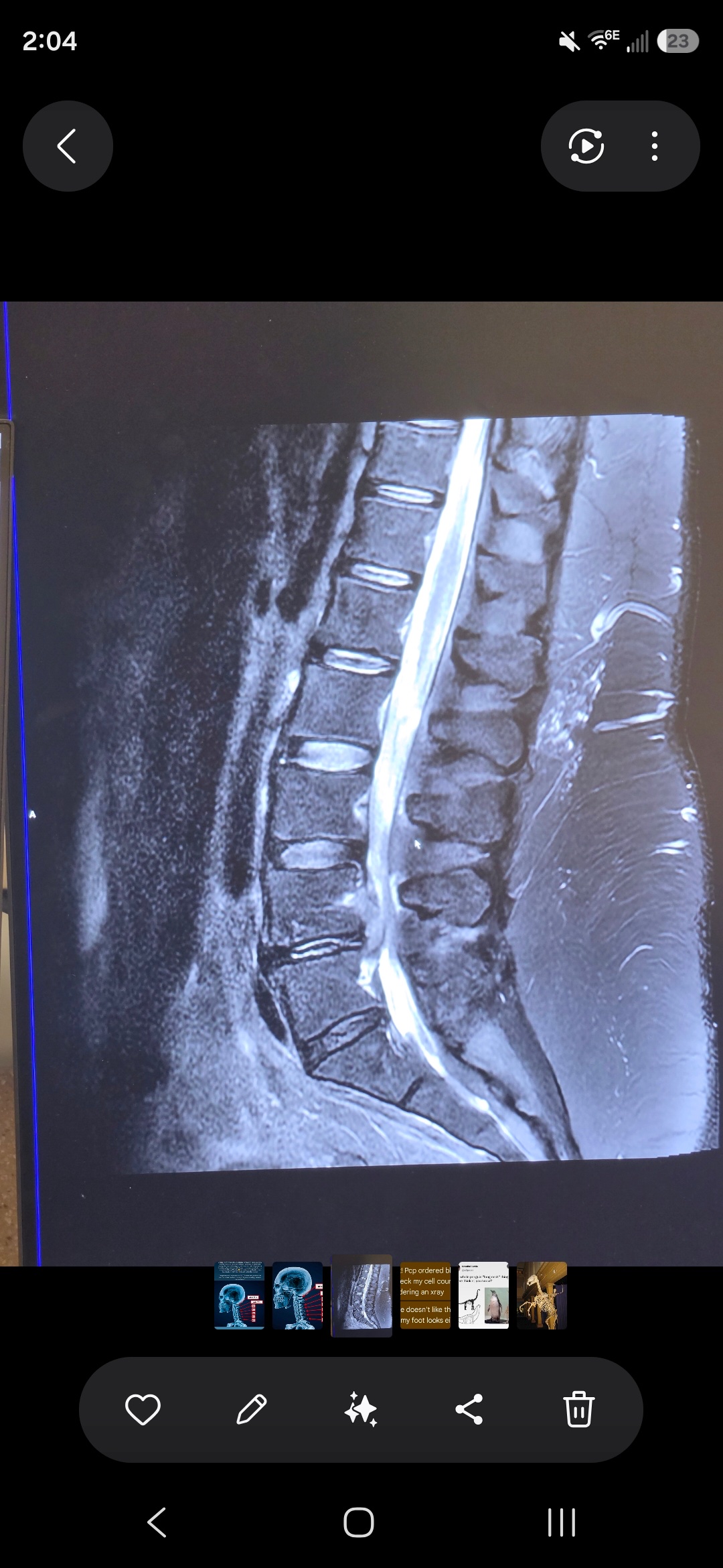 Help this helper get back on her feet! campaign photo, 4 of 6