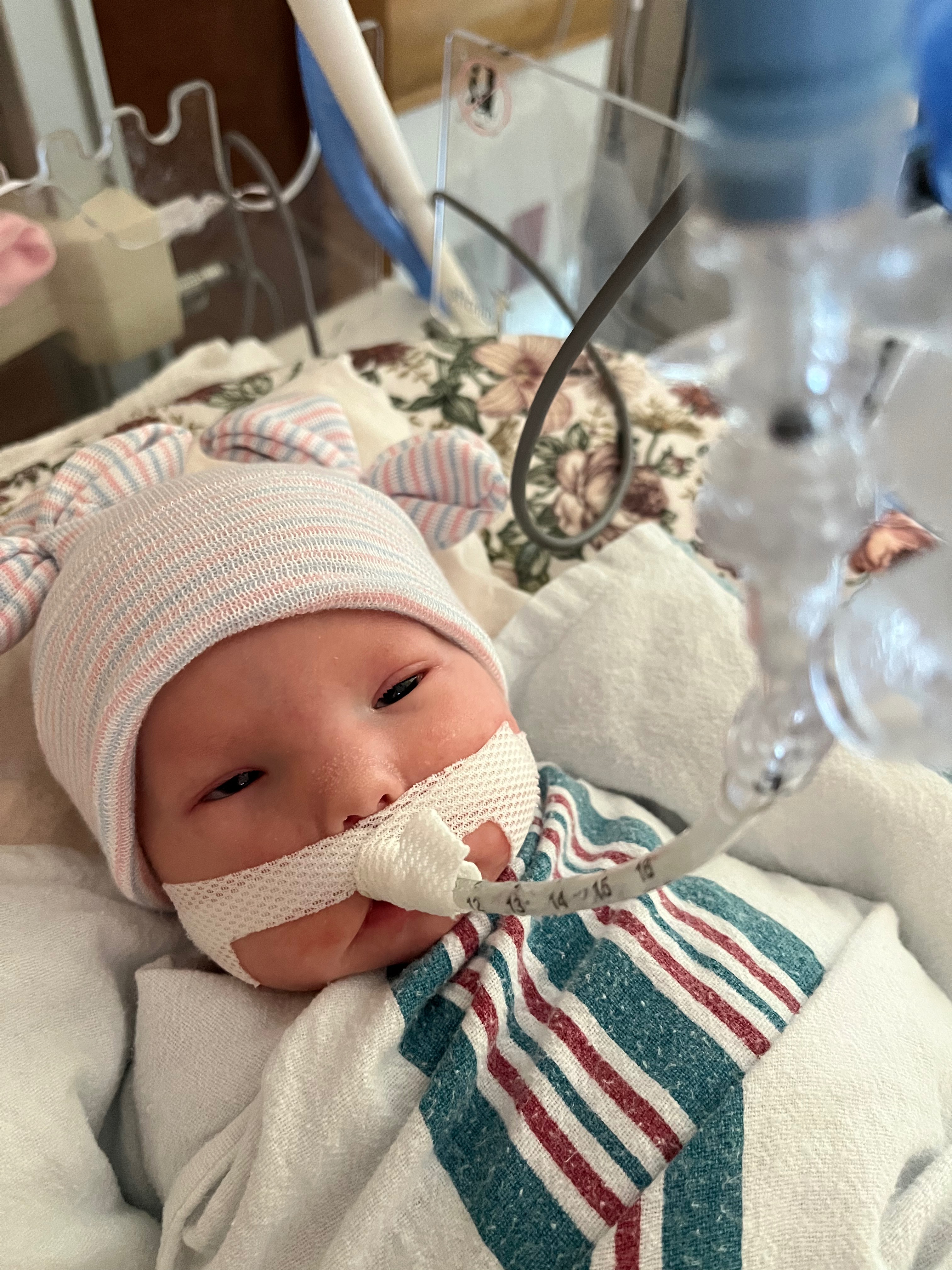 Support little Ruth and her life long medical journey campaign photo, 2 of 5