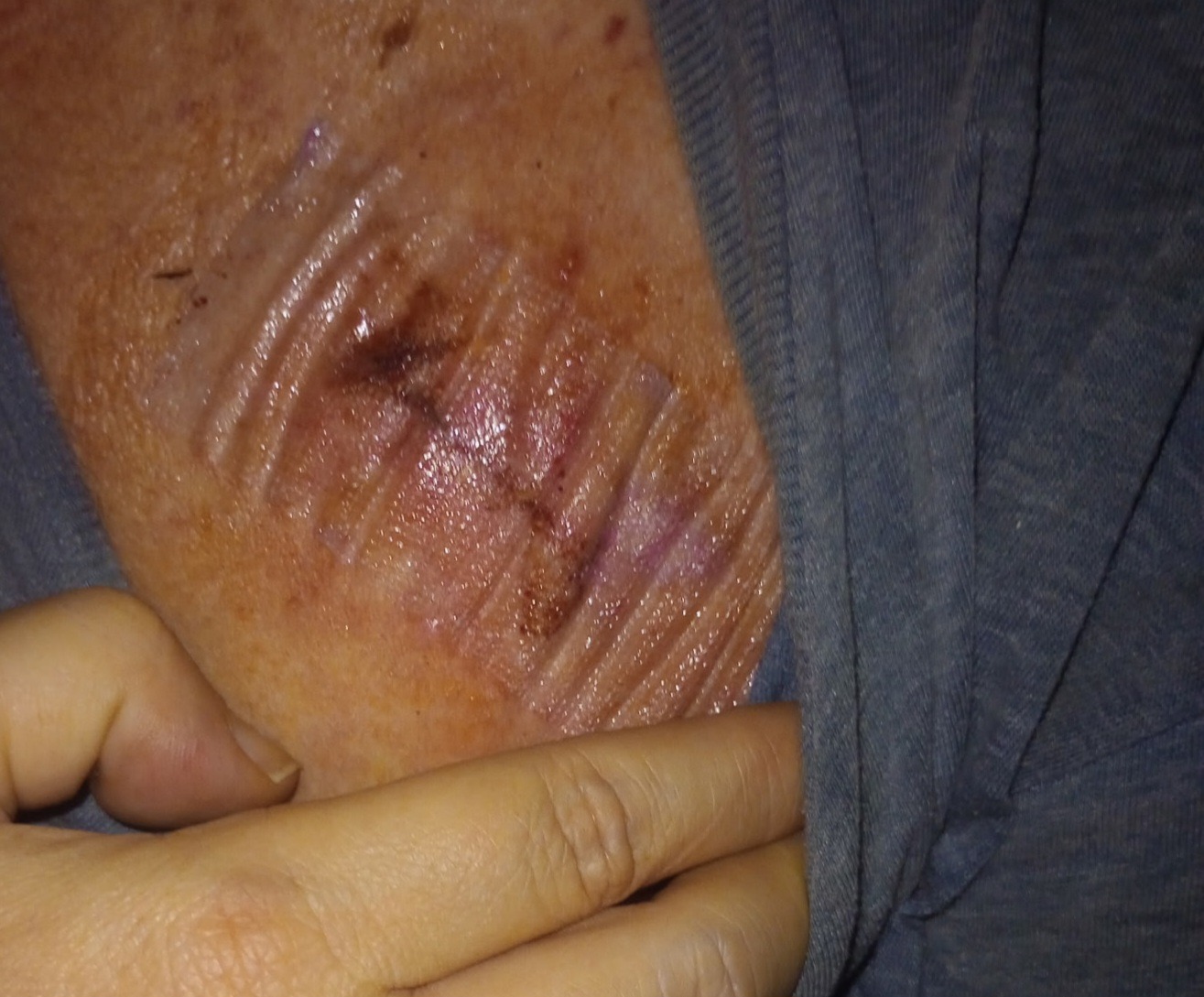 - Emergency Medical Fund for Heather – Every Bit Helps campaign photo, 4 of 7