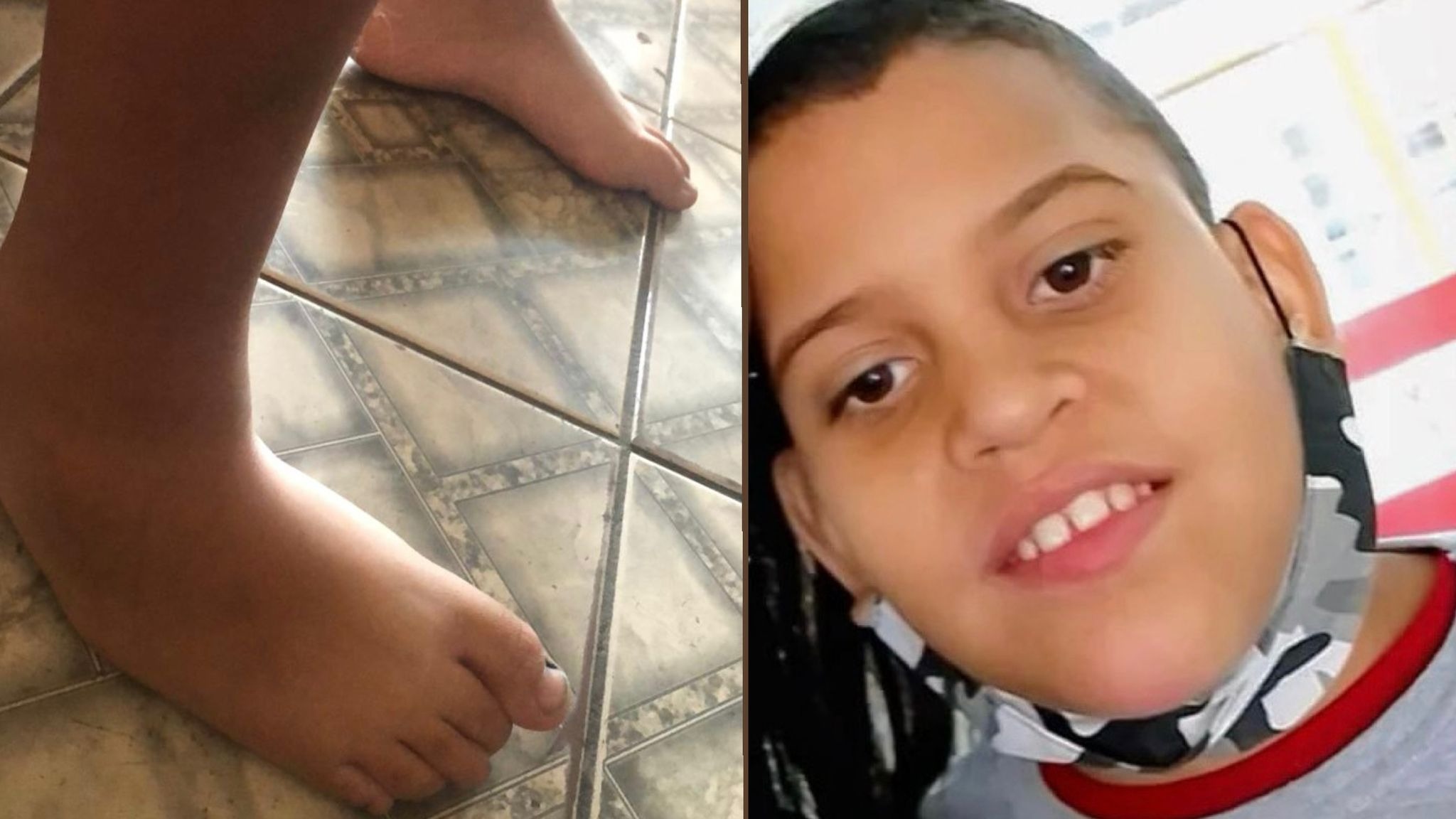 Help Vitor, my autistic son, walk again campaign photo, 6 of 8