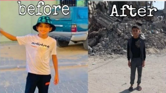 Help Omar and His Family Survive Gaza Crisis photo