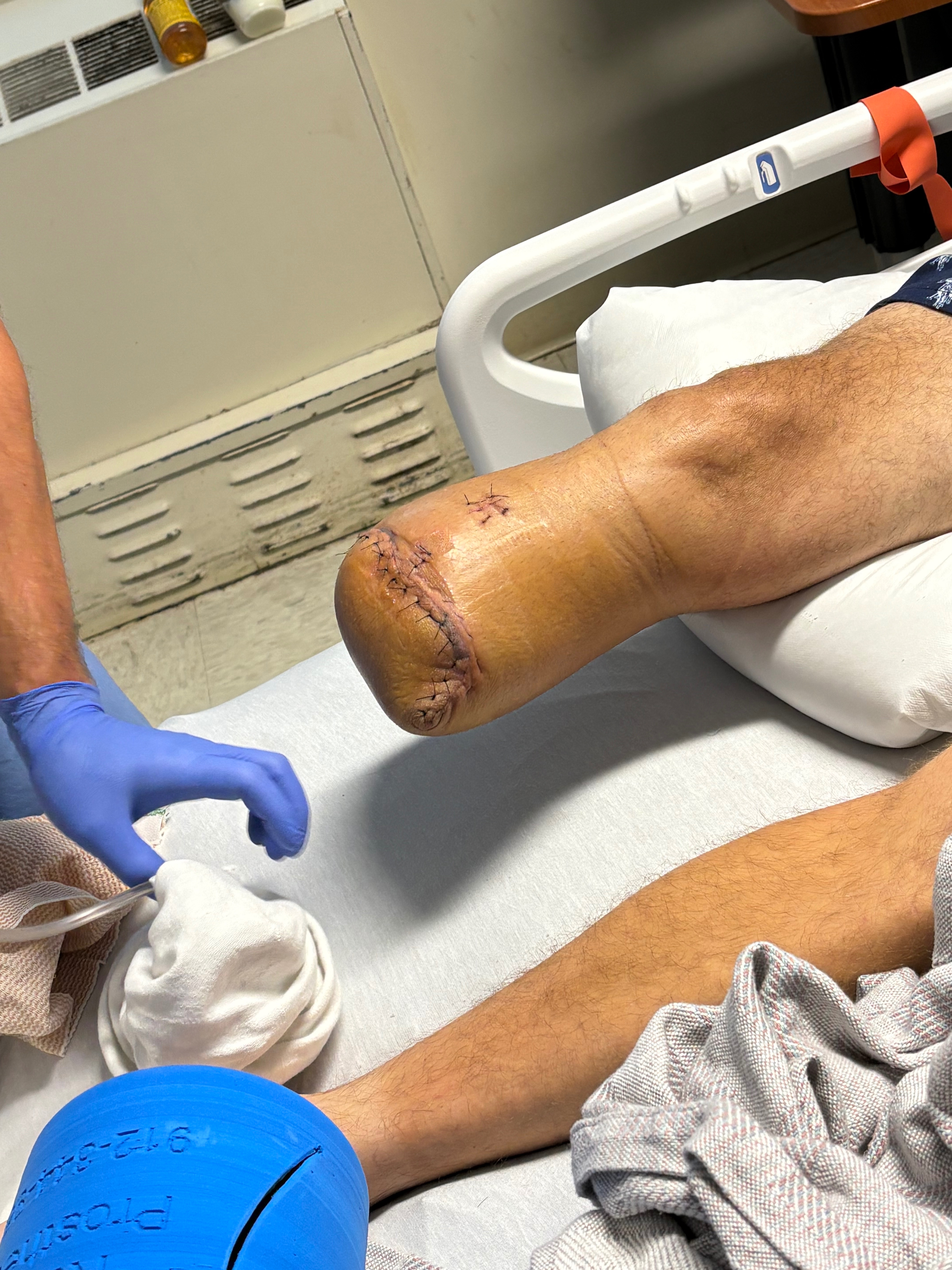 Help support Jeremy on his road to recovery campaign photo, 2 of 7