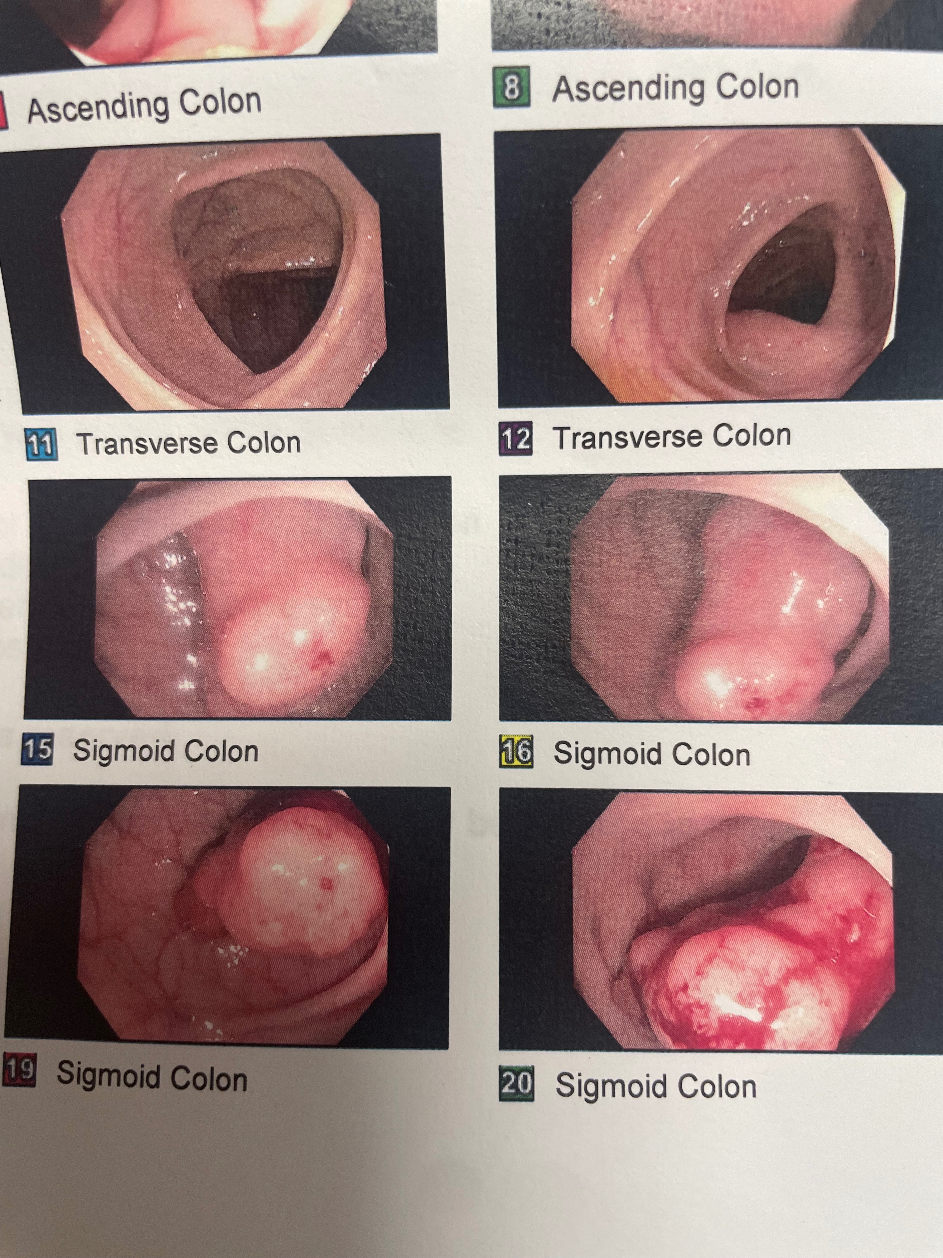 Support Mom's Battle Against Colon Cancer campaign photo, 4 of 7