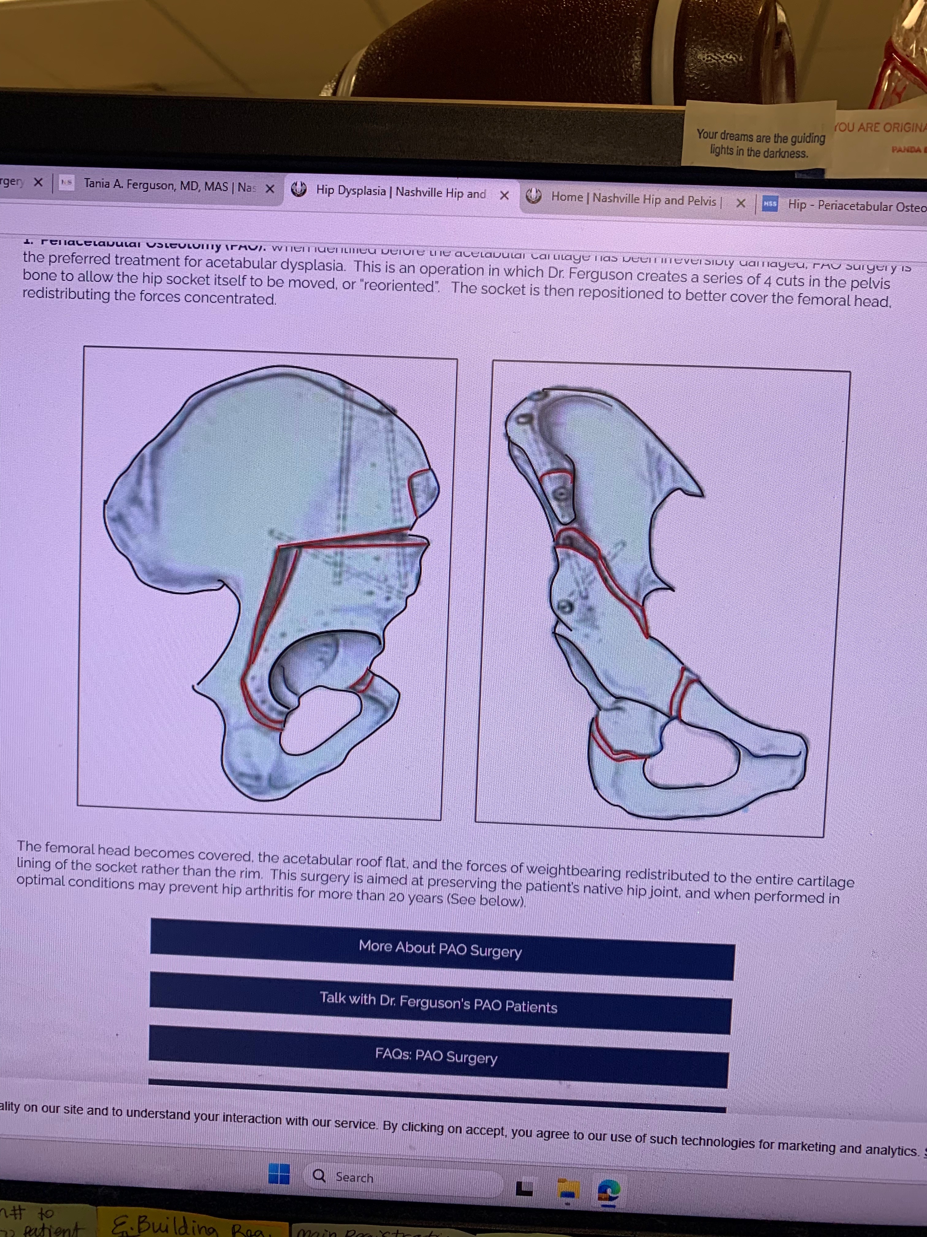 Donate to Melanie's Critical Hip Surgery campaign photo, 6 of 7