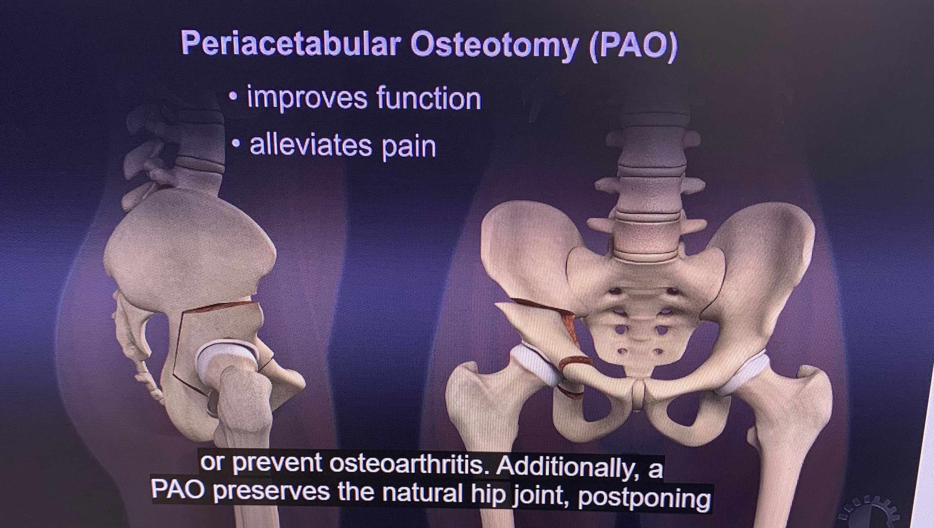 Donate to Melanie's Critical Hip Surgery campaign photo, 2 of 7