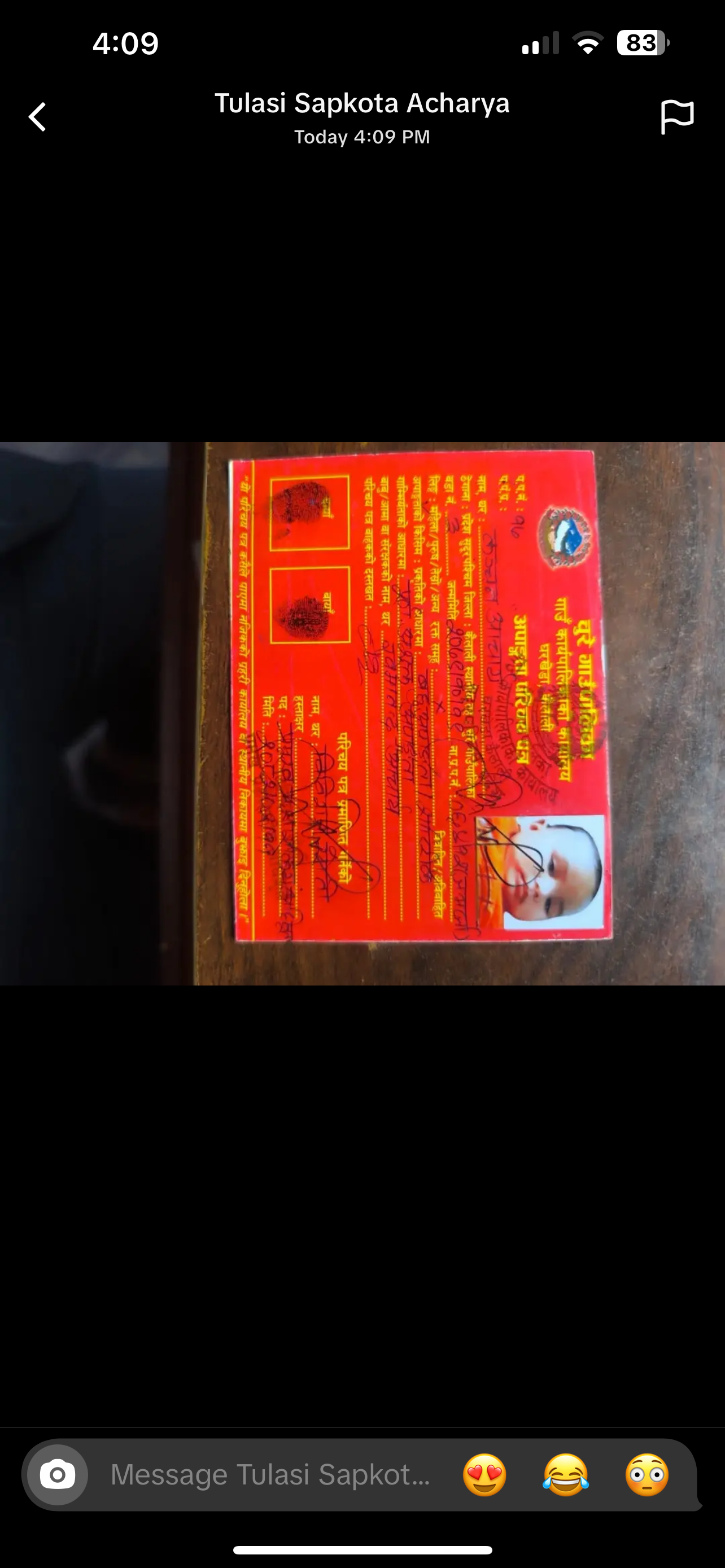 Help 32 months old kanchan GM 1 gangliosidosis type II campaign photo, 6 of 8