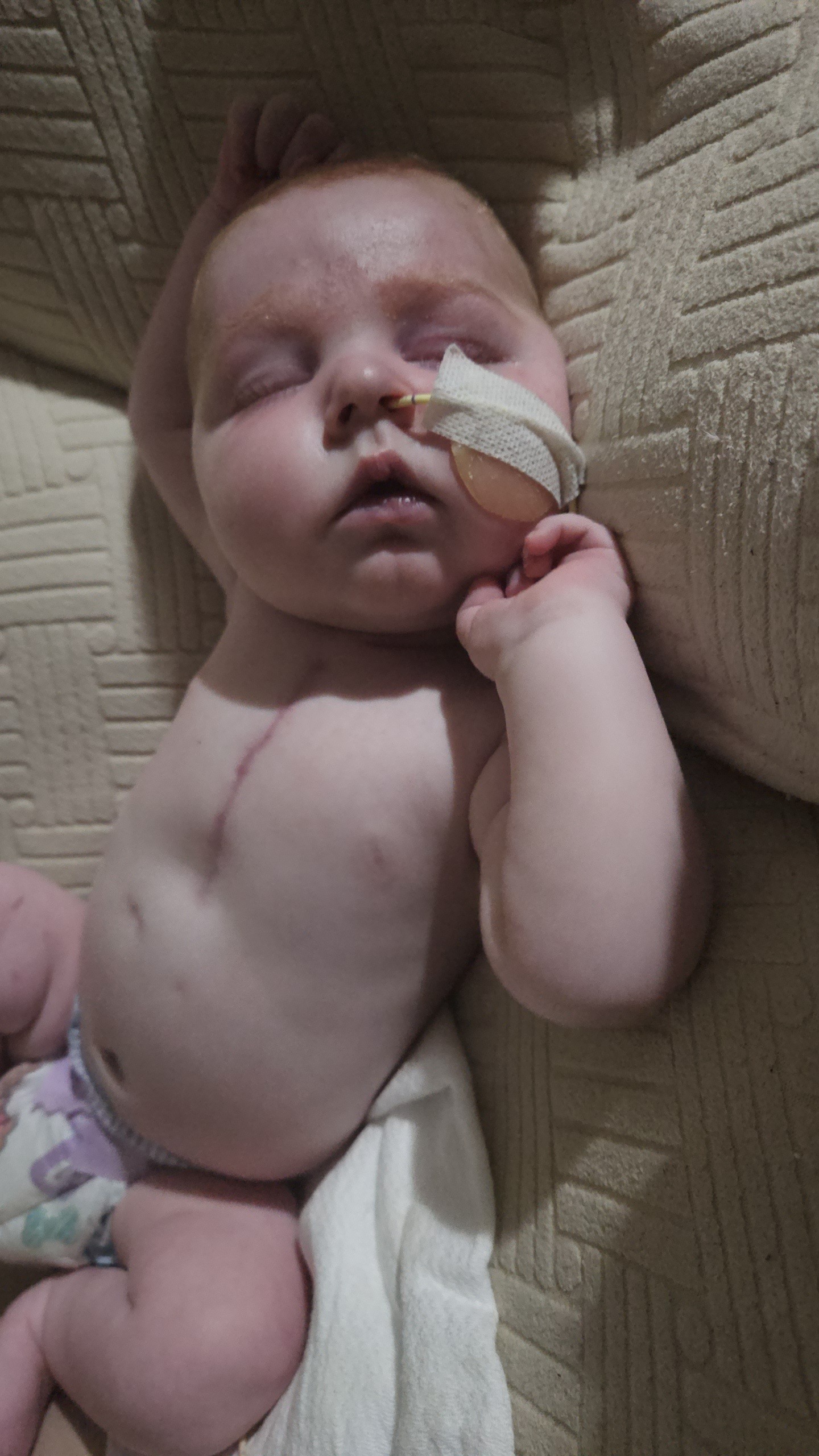TinyHeart,BigFight:HelpSupport Maverick's Journey with HLHS campaign photo, 2 of 8