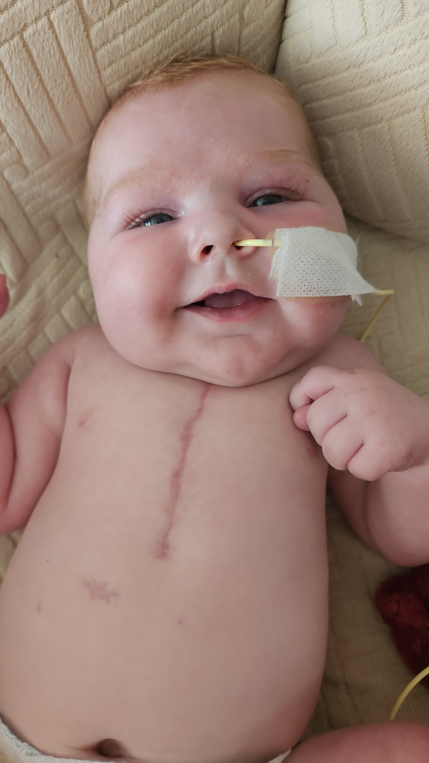 TinyHeart,BigFight:HelpSupport Maverick's Journey with HLHS campaign photo, 4 of 8