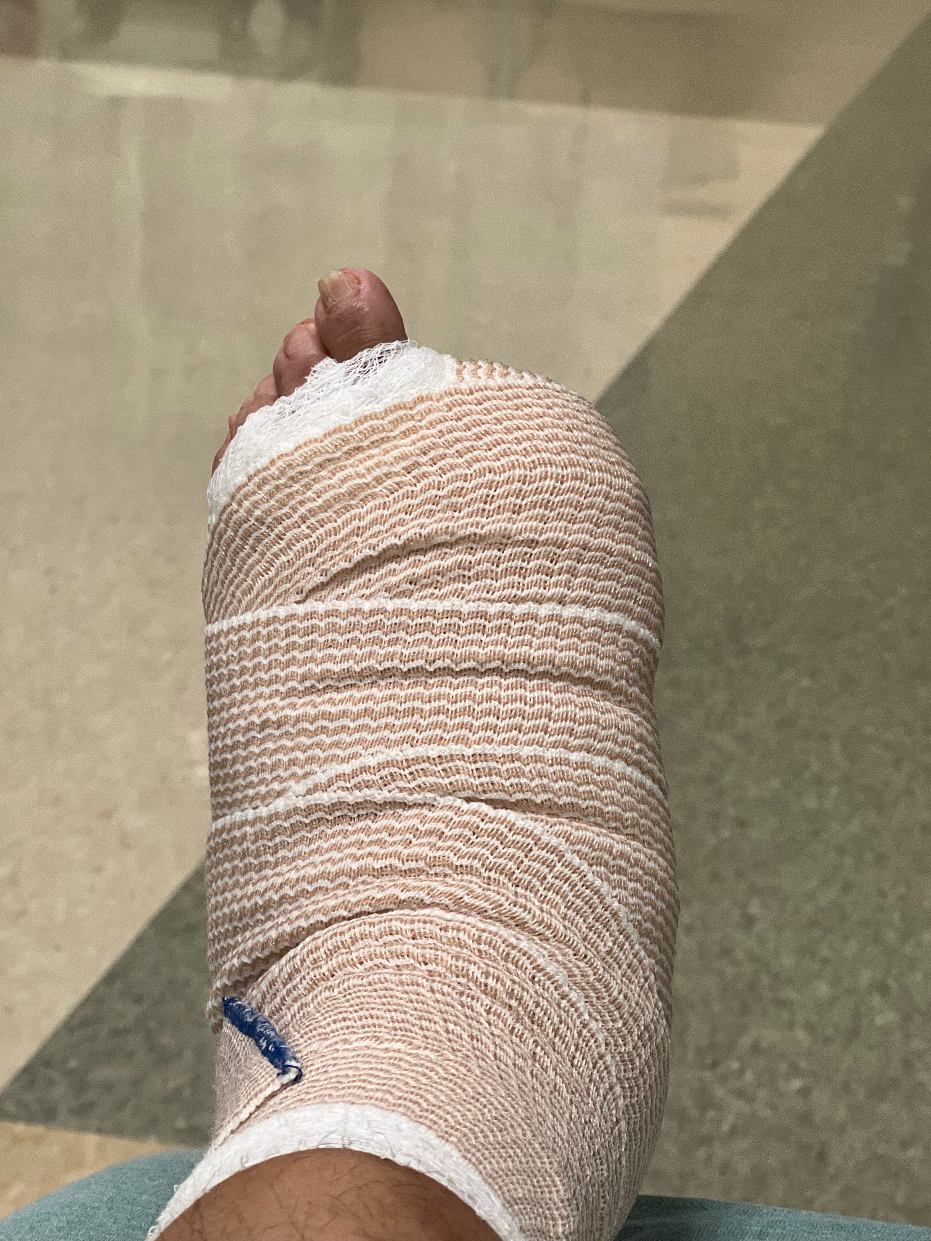 Urgent Help Needed for Toe Amputation and Recovery campaign photo, 5 of 7
