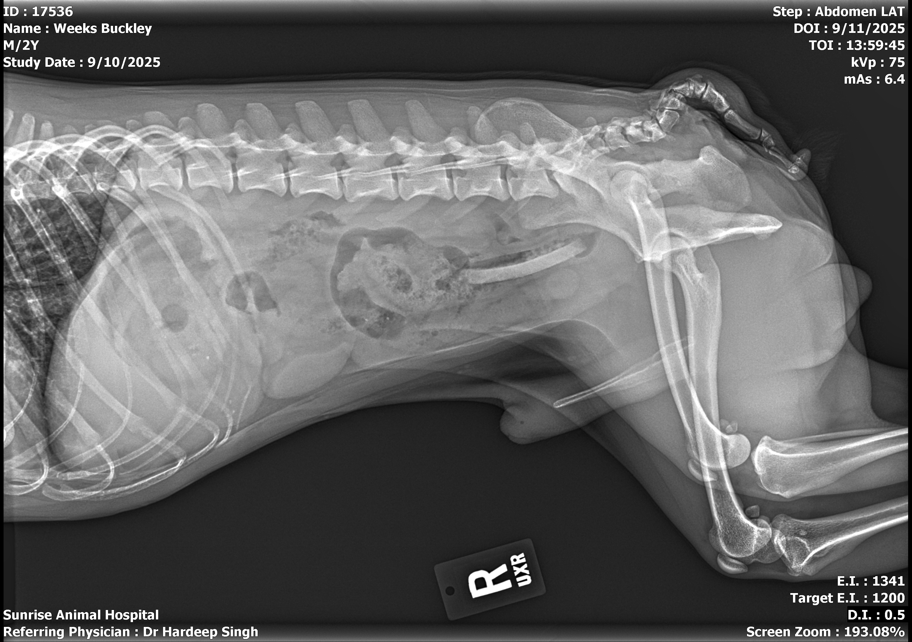 Emergency surgery for blockage campaign photo, 5 of 6