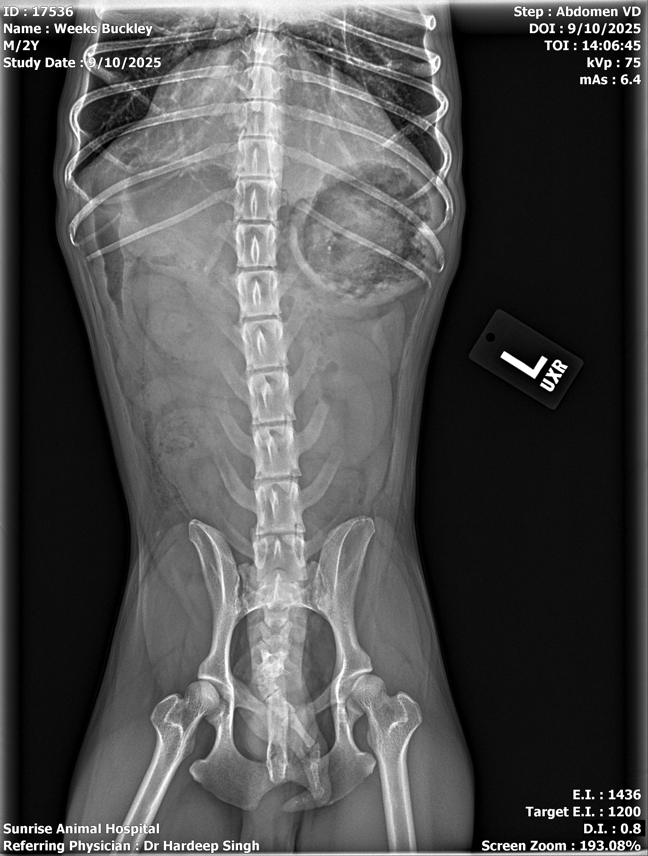 Emergency surgery for blockage campaign photo, 2 of 6