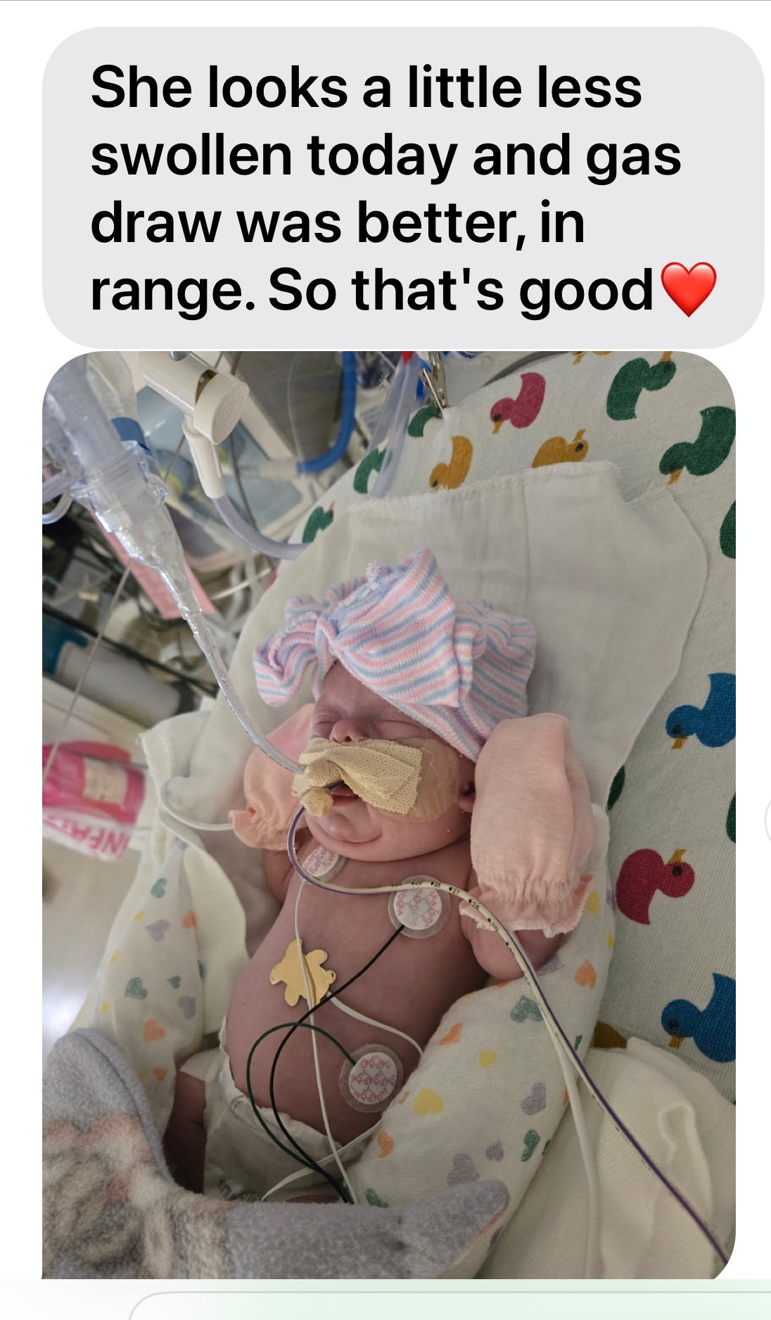 Tiny But Mighty: Standing With Baby Aurora campaign photo, 5 of 7