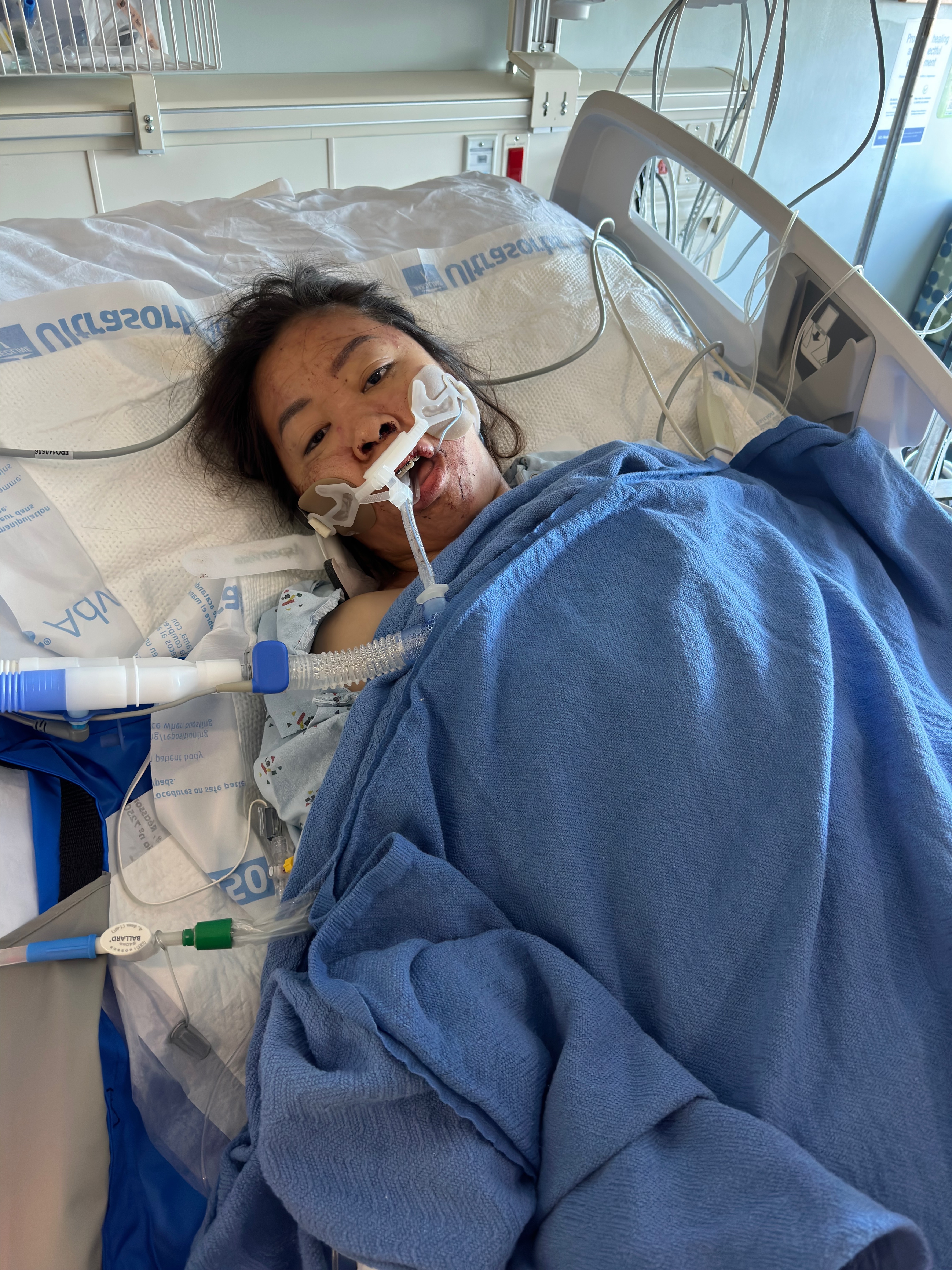 Help Honey Heal and Recover from Her Heroic Act of Courage campaign photo, 7 of 8