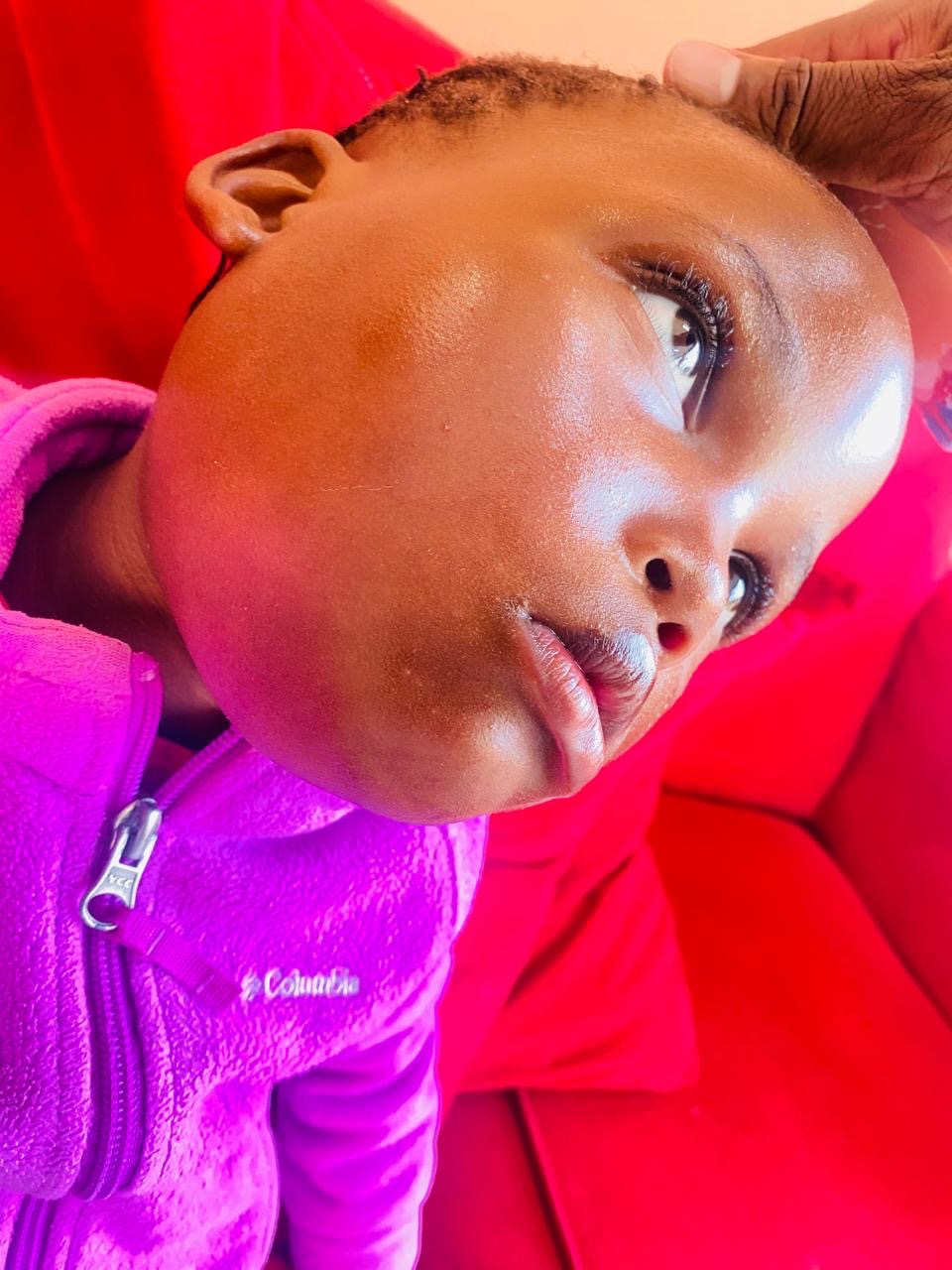 a 3 year-old orphan’s journey through tumor removal campaign photo, 2 of 7