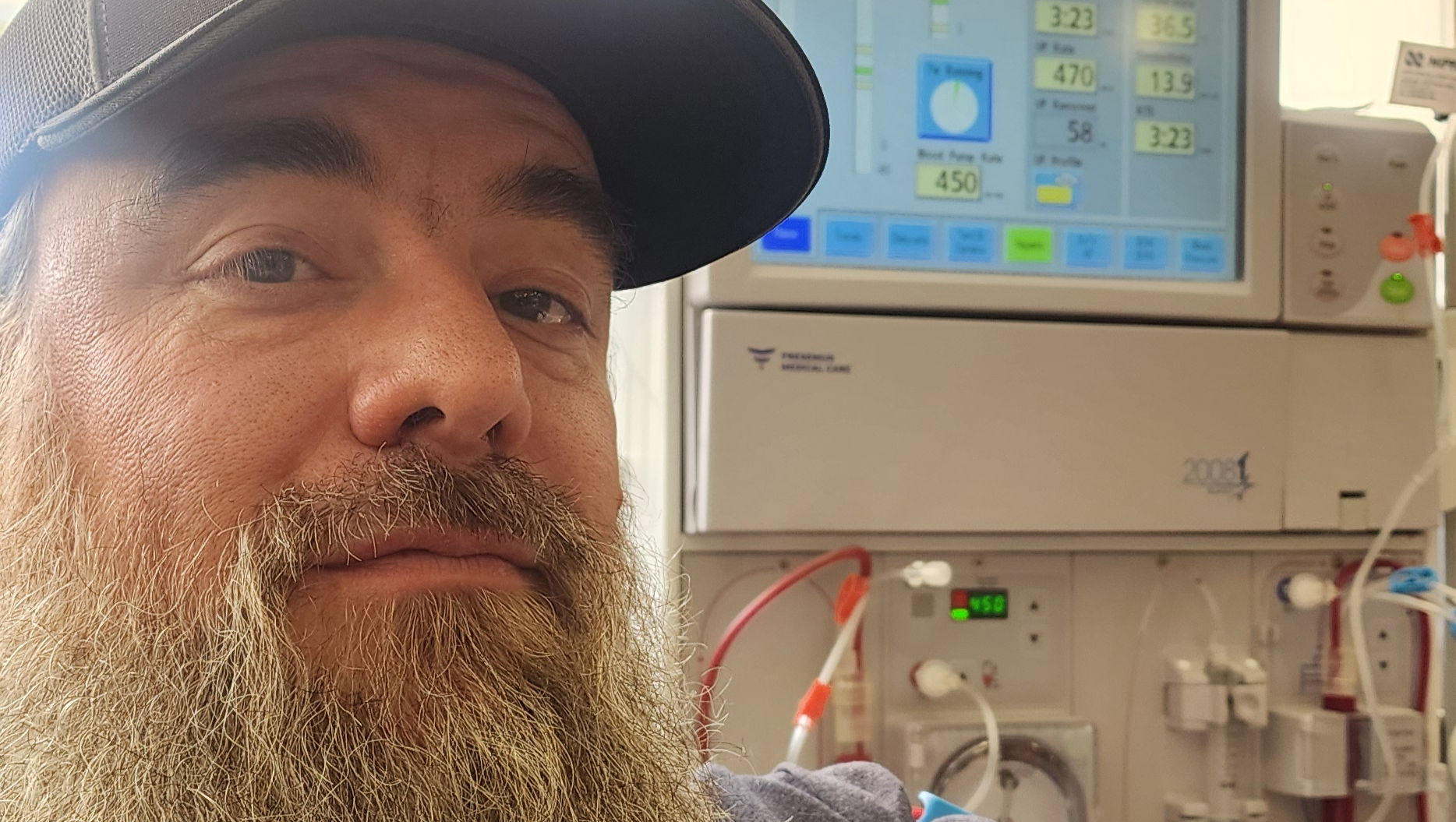 Fundraiser by Nicholas Doute : Support Nicholas Through Renal Failure
