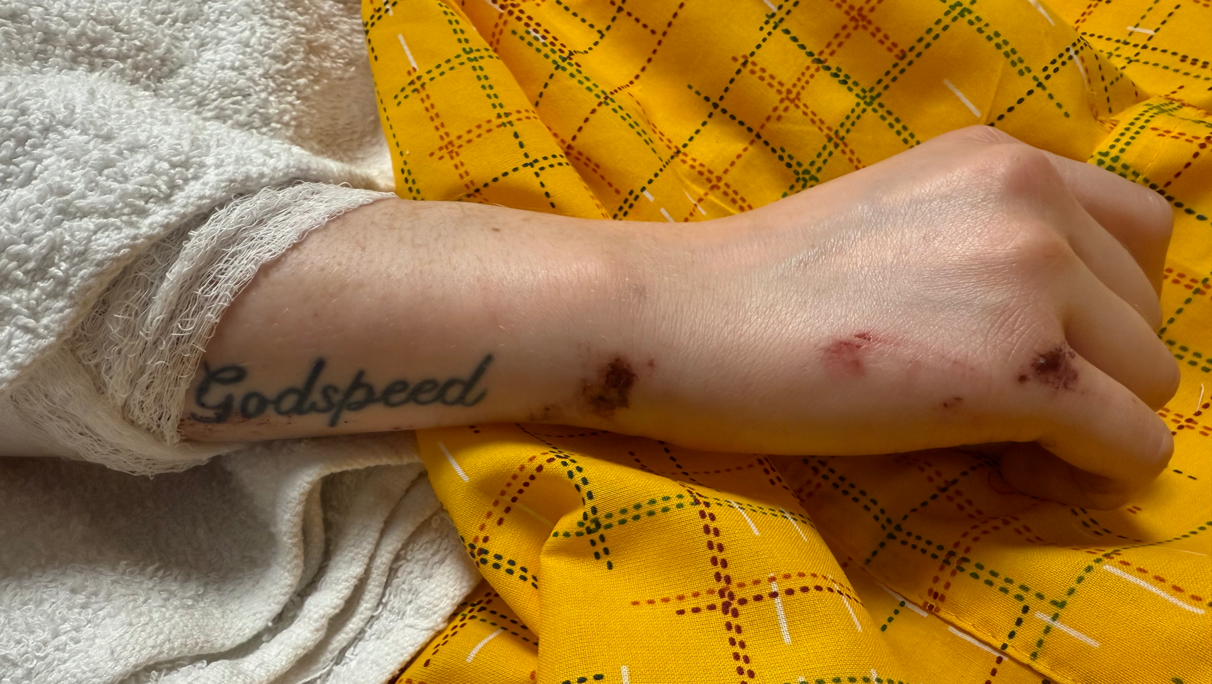 Support Chelsey's Road to Recovery photo