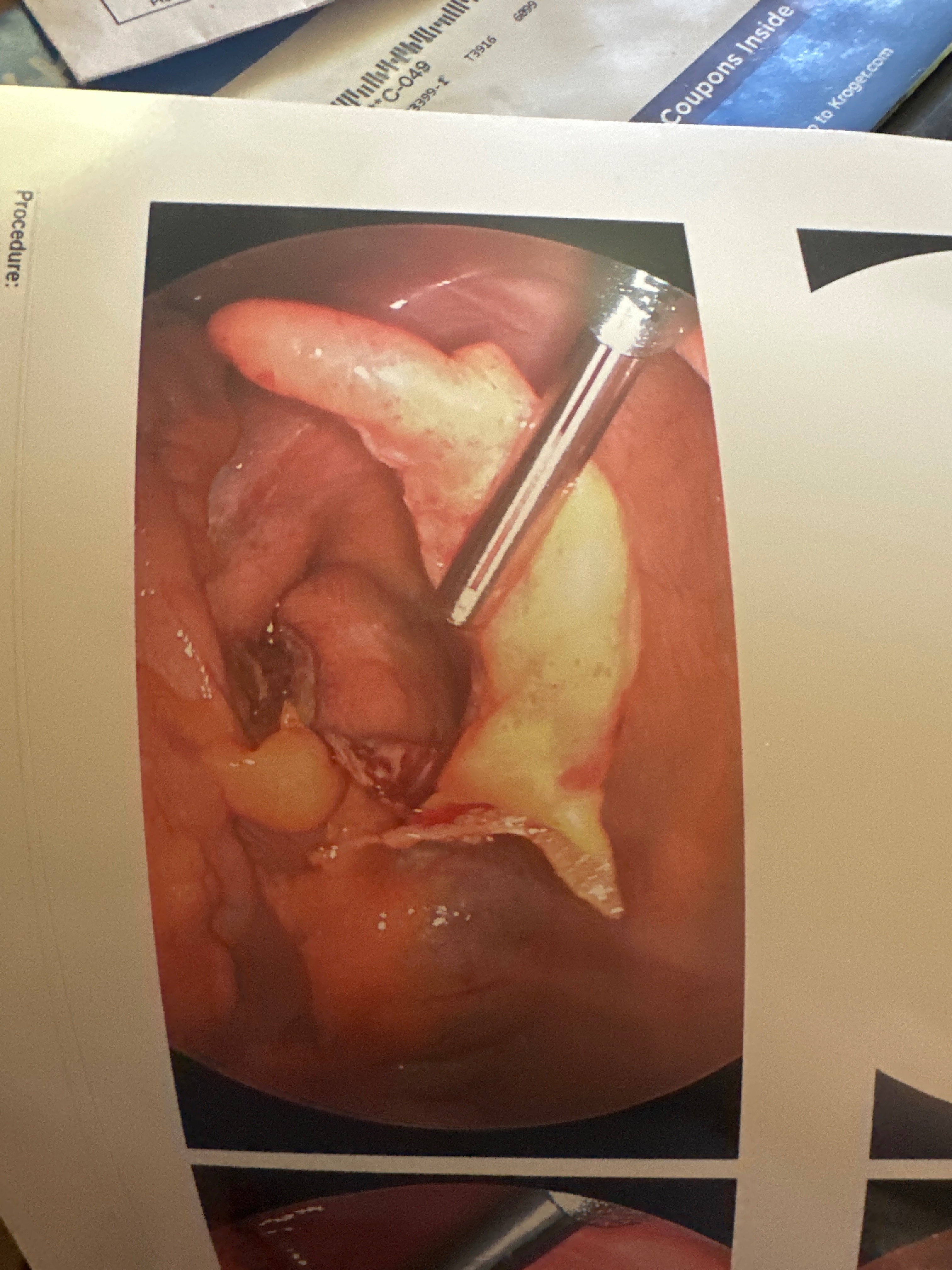 Support Needed After Emergency Surgery campaign photo, 2 of 4