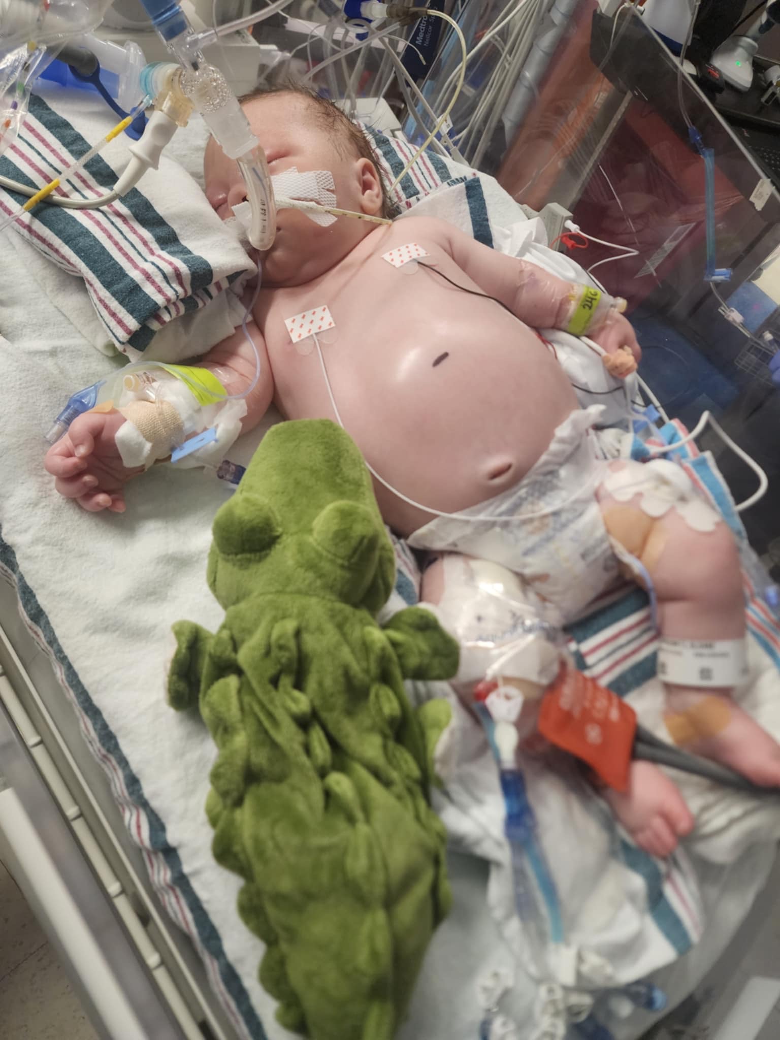 Baby Sloane’s Neuroblastoma Fund campaign photo, 4 of 5