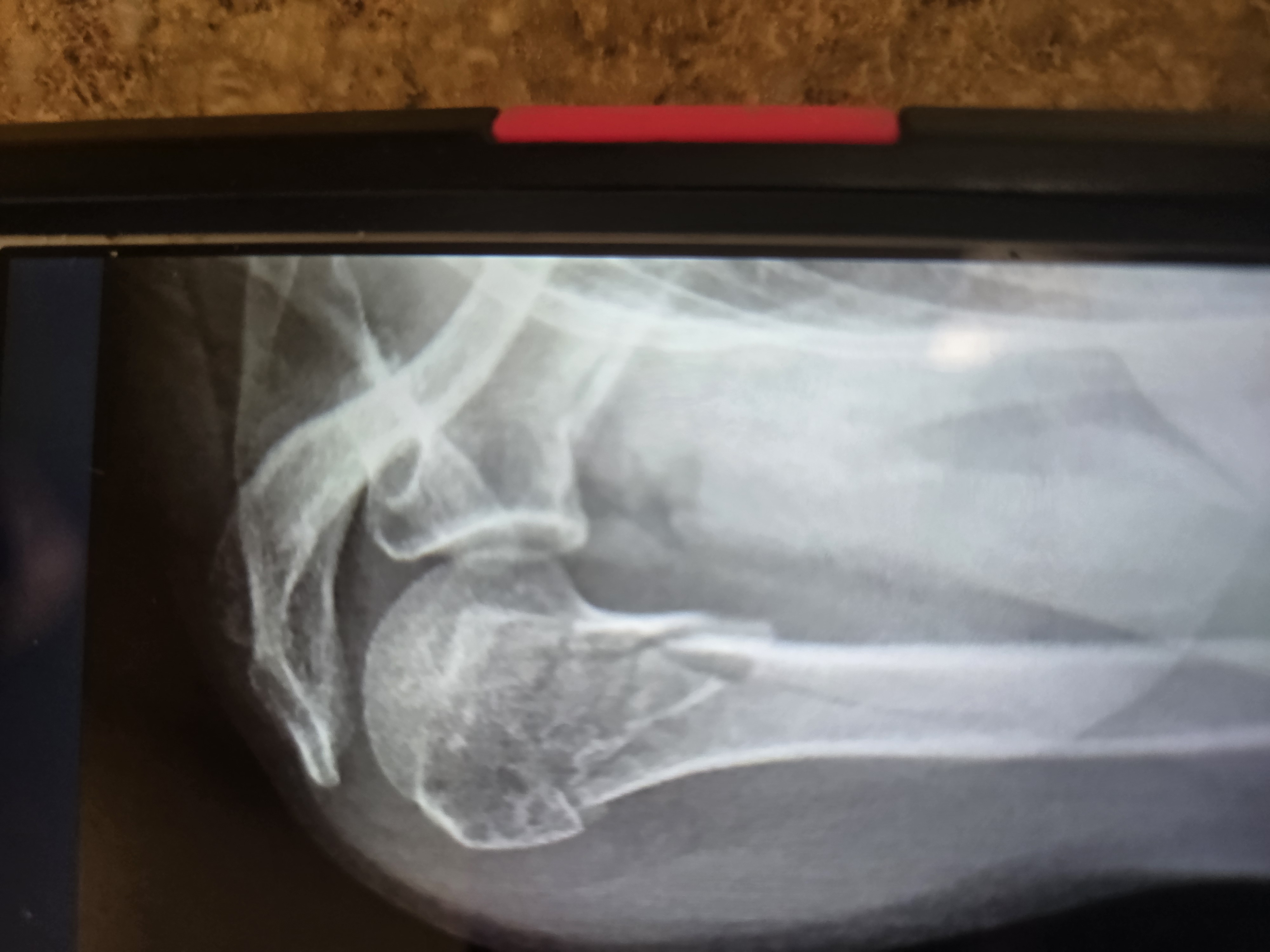 Urgent Help Needed for Surgery and Living Costs campaign photo, 6 of 7