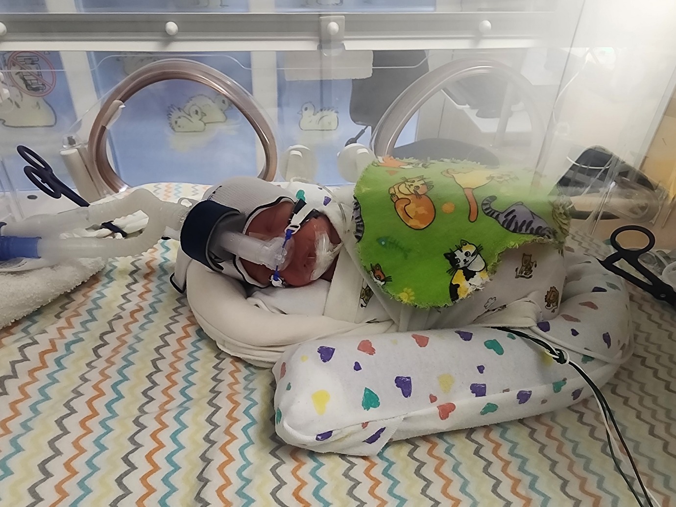 NICU Baby Needs Your Support campaign photo, 7 of 8