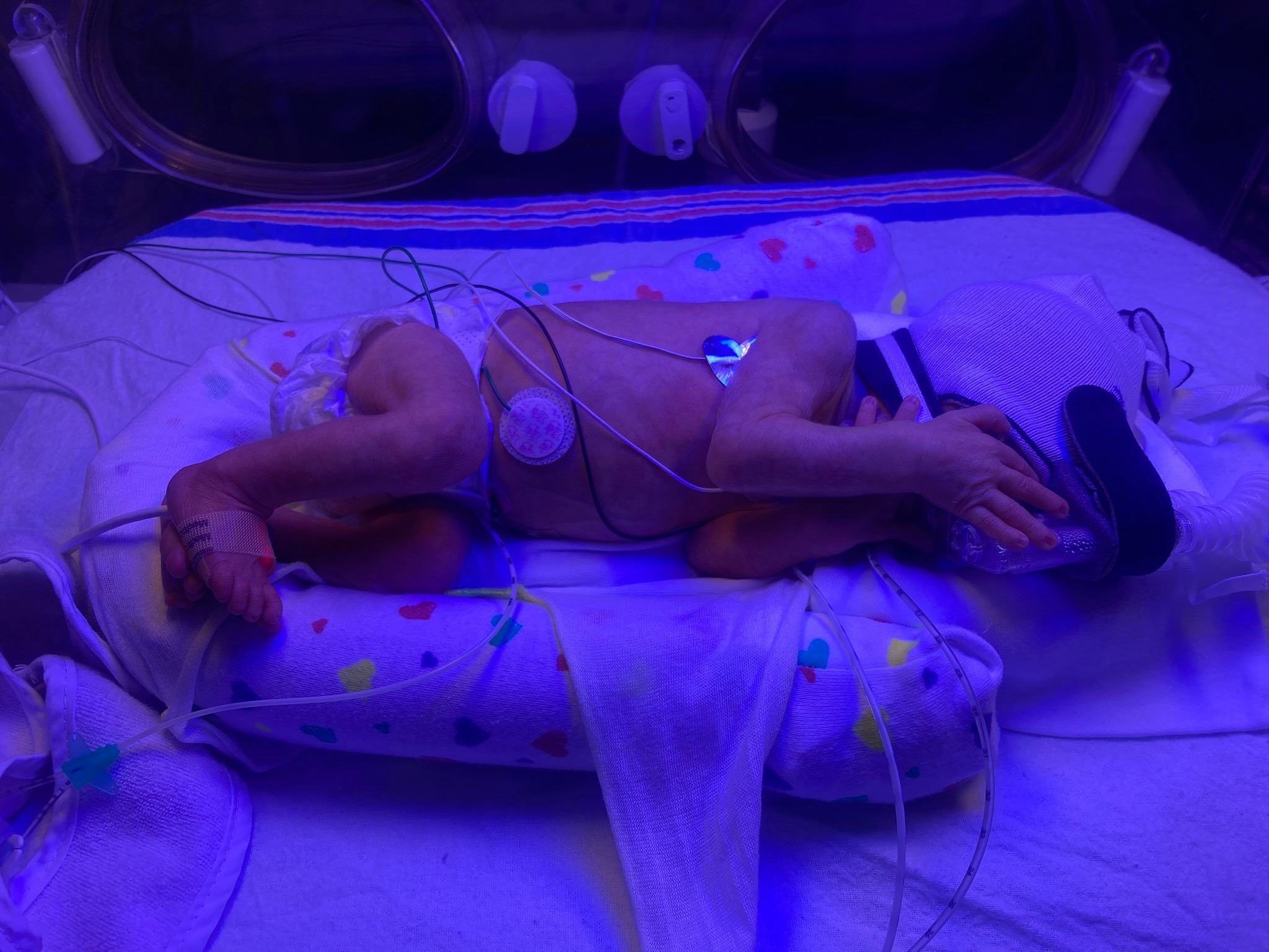 NICU Baby Needs Your Support campaign photo, 2 of 8