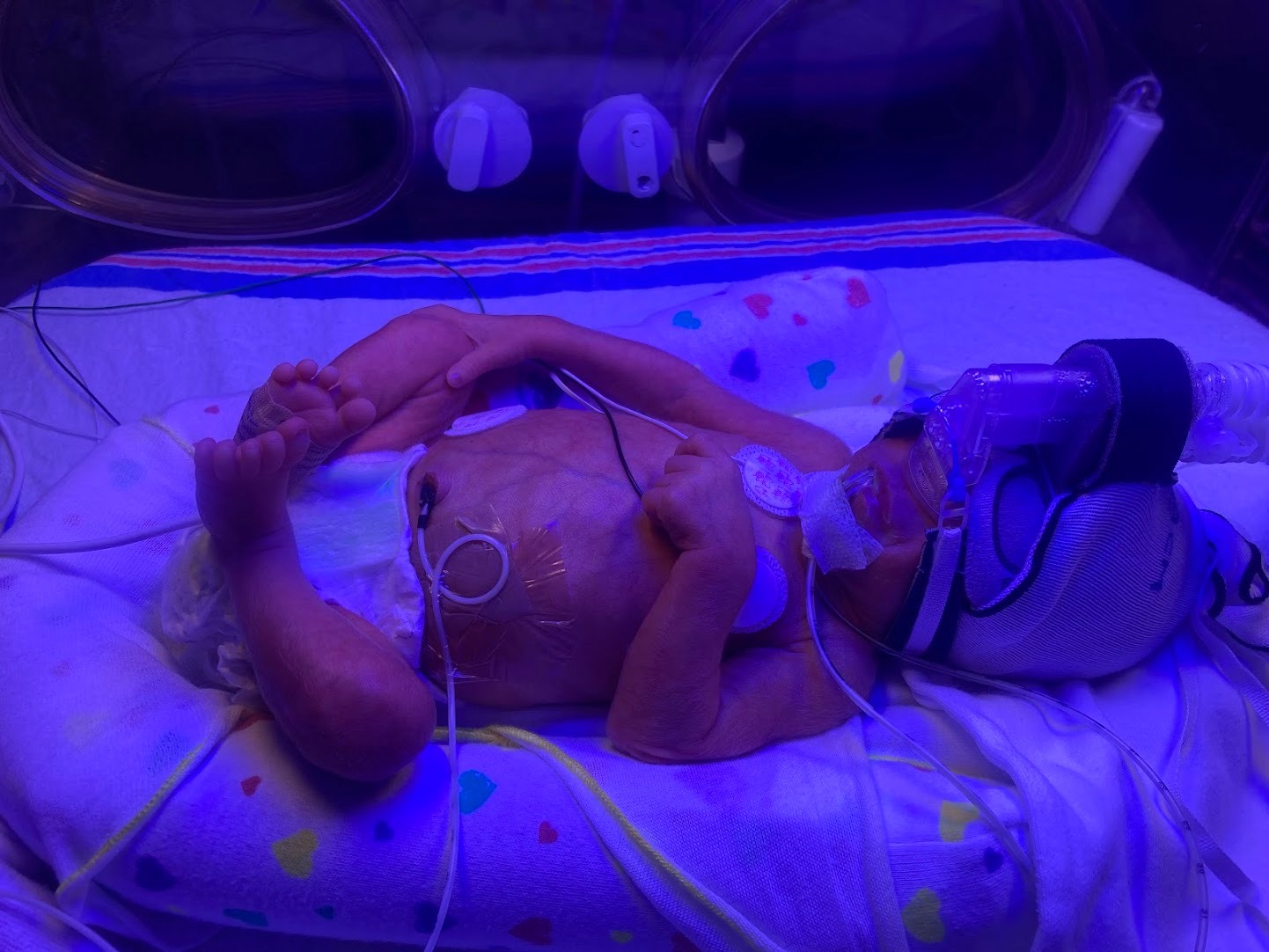 NICU Baby Needs Your Support campaign photo, 5 of 8