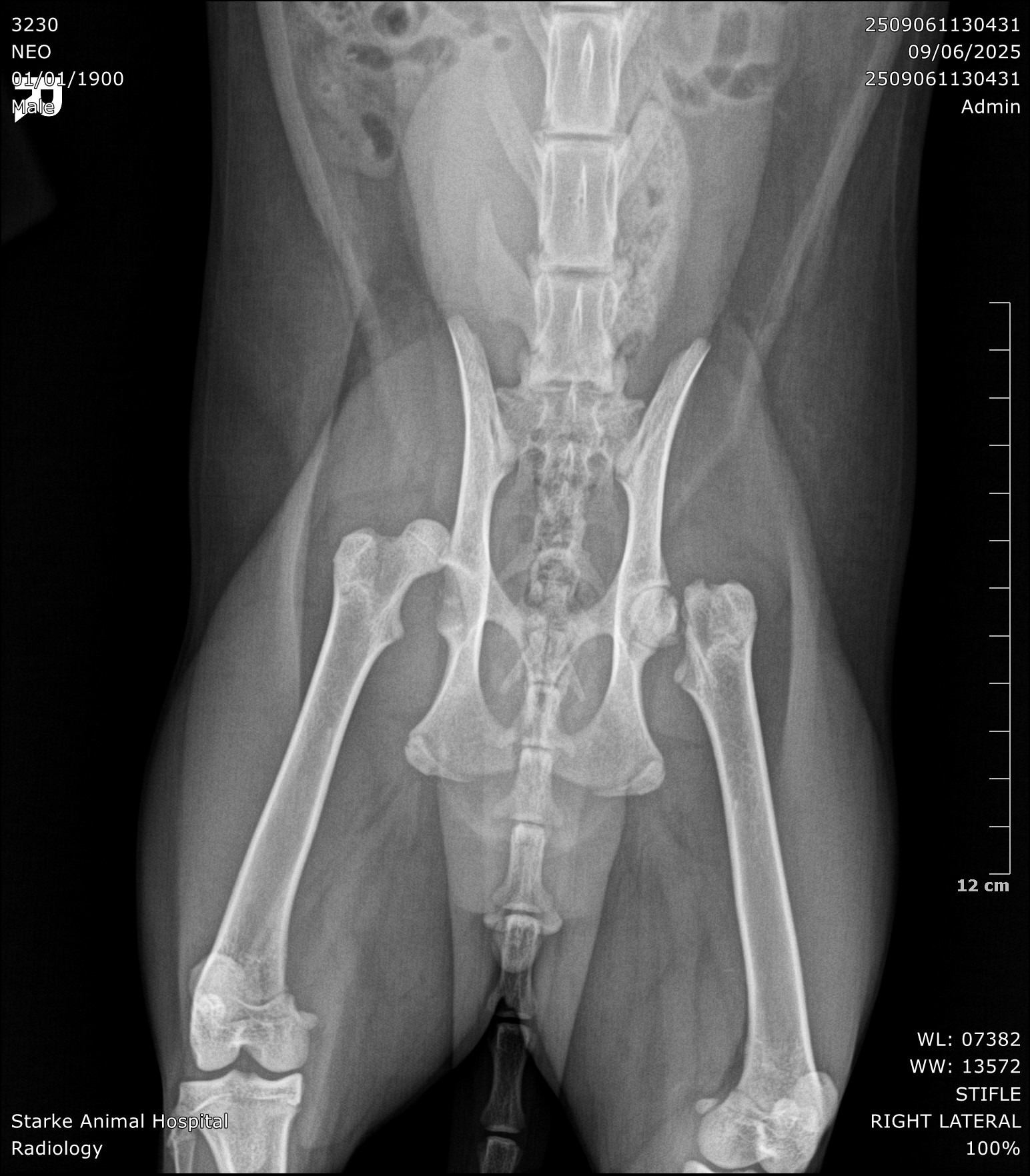 Help Neo Walk Again: Support His Surgery campaign photo, 2 of 7