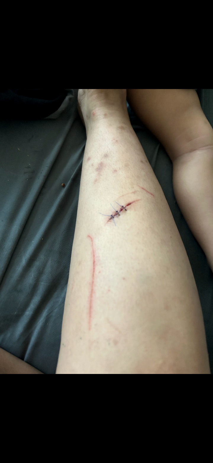 Help A Mom Of 3 Recover From A Car Accident campaign photo, 4 of 7