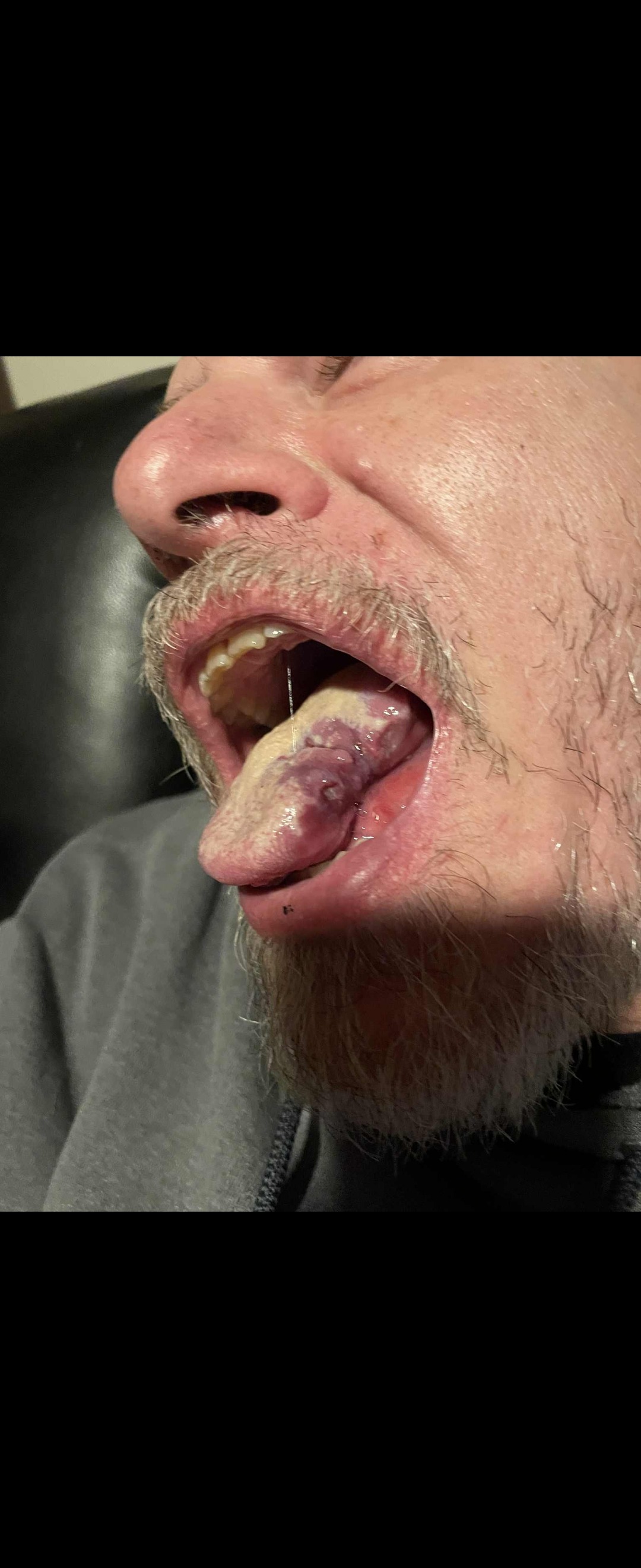 Help Guy Sharp BEAT oral Cancer! CANCER SUCKS! campaign photo, 6 of 8