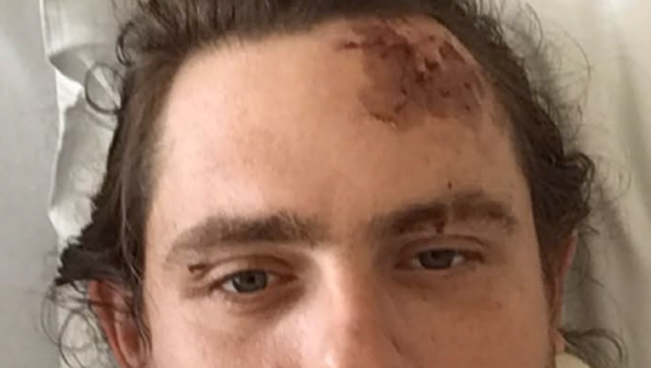 Help Sabatino Recover from Devastating Accident