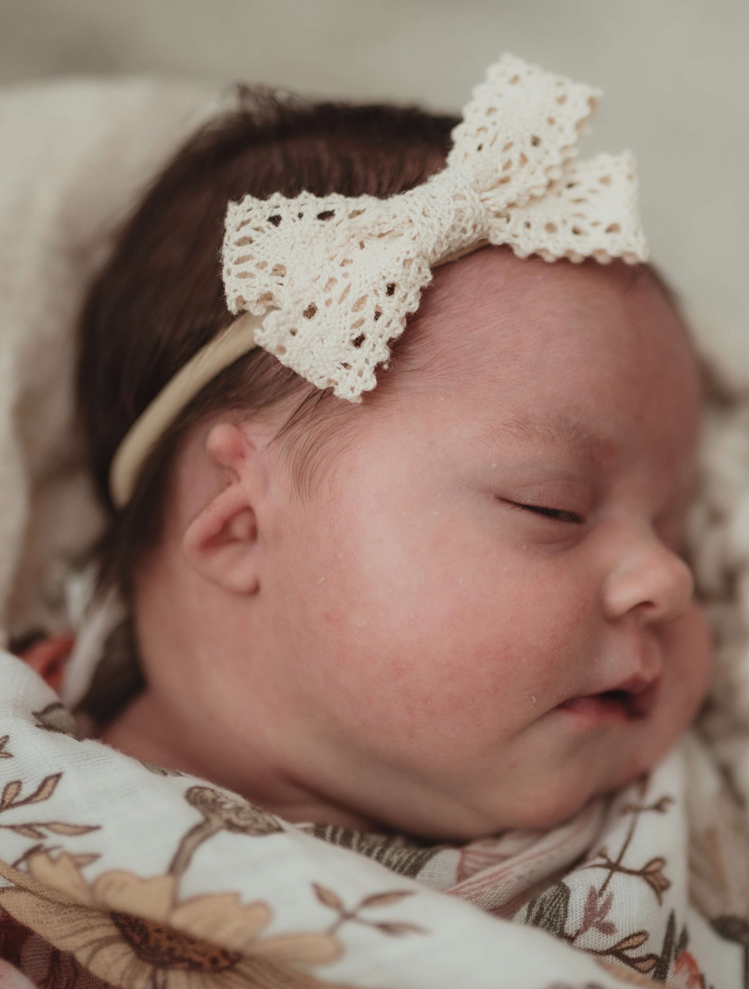 Emery's Microtia Surgery campaign photo, 5 of 8