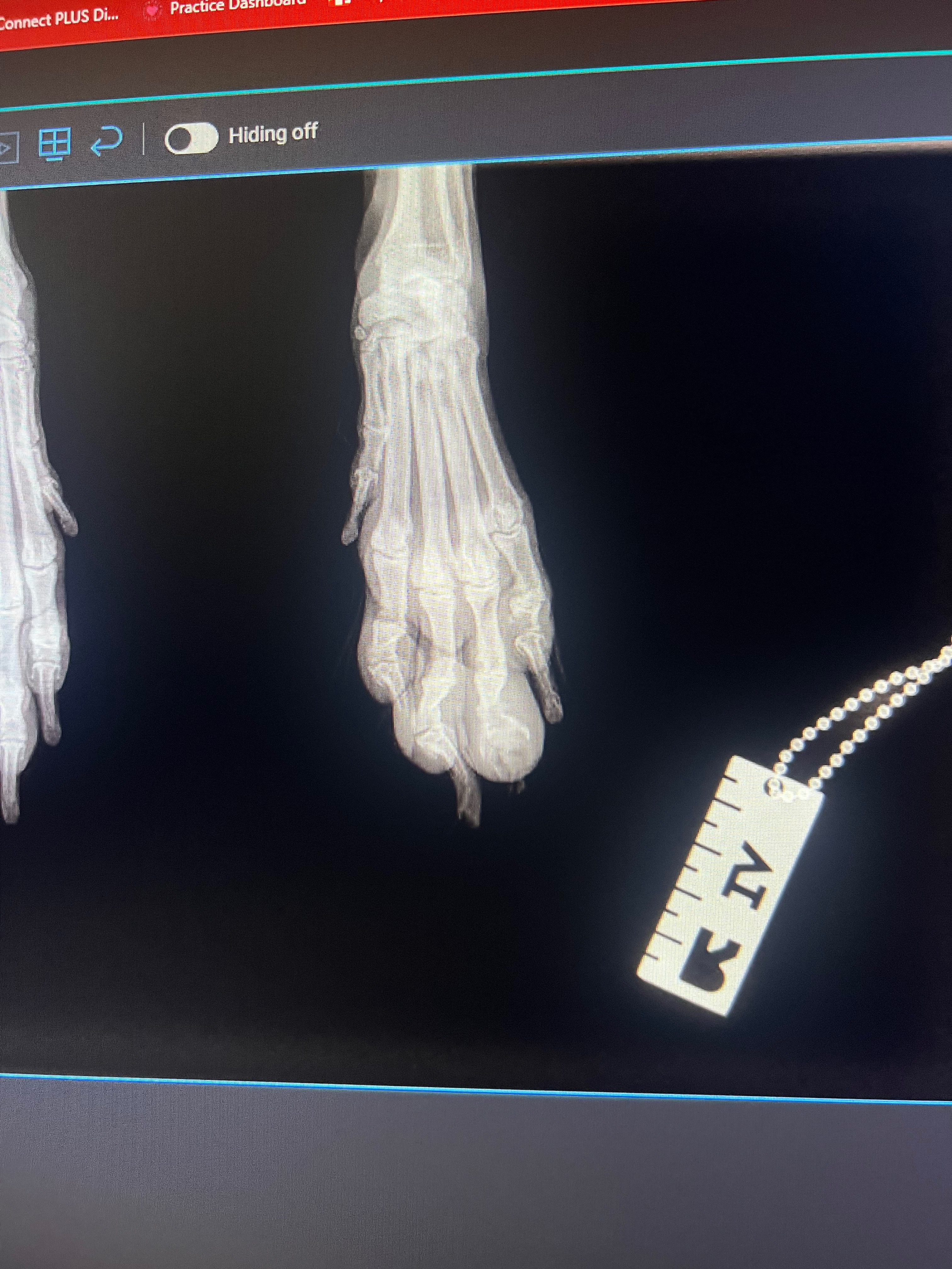 Help Ozil Get Surgery for his cancer campaign photo, 5 of 6