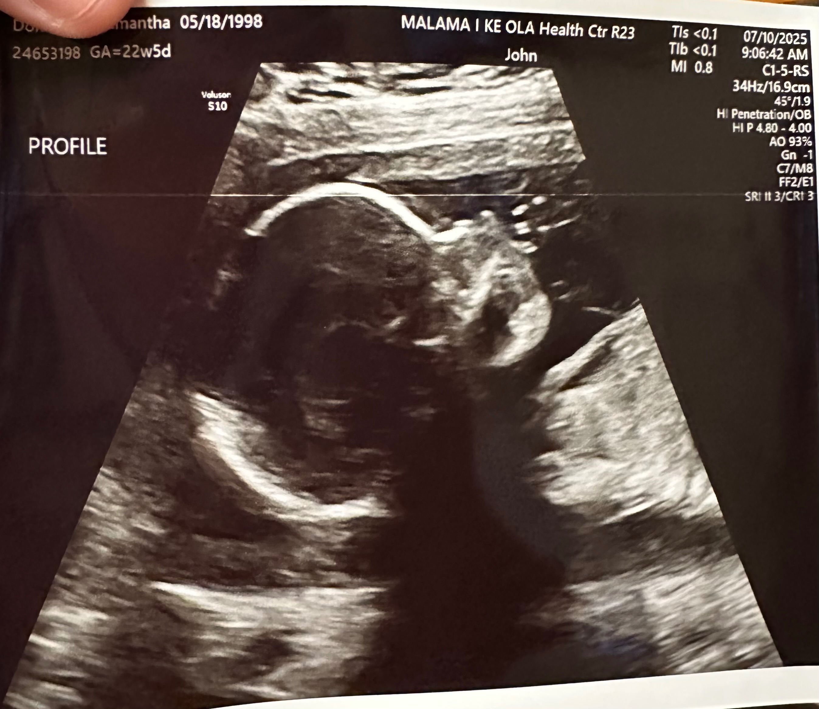 Support Sam's Family During Hospital & NICU Stay campaign photo, 5 of 6