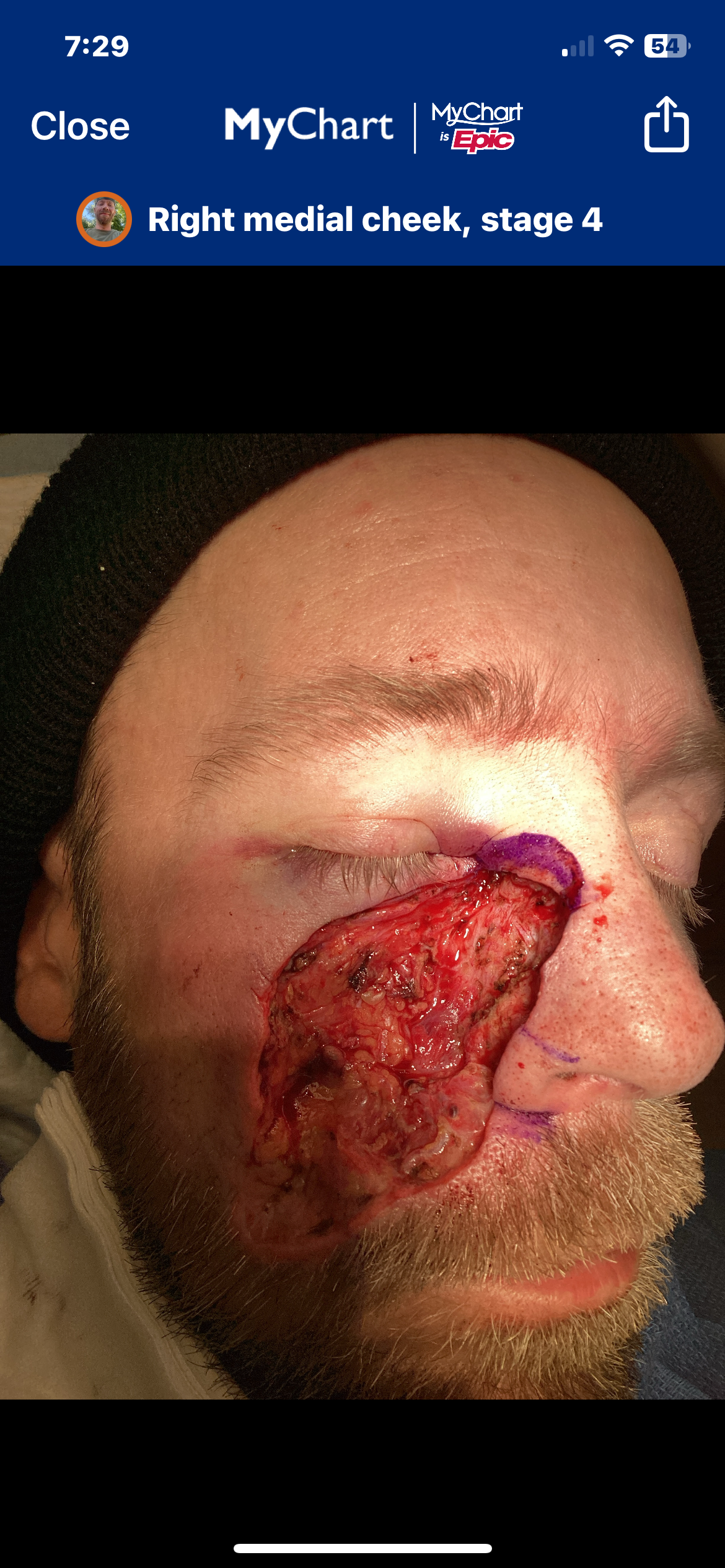 Veteran fighting Cancer campaign photo, 6 of 8