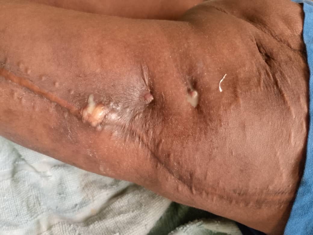 Donate to help Adetoun Adeyemi get her surgery done campaign photo, 7 of 8