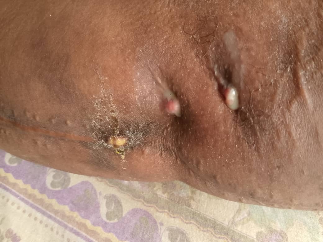 Donate to help Adetoun Adeyemi get her surgery done campaign photo, 2 of 8