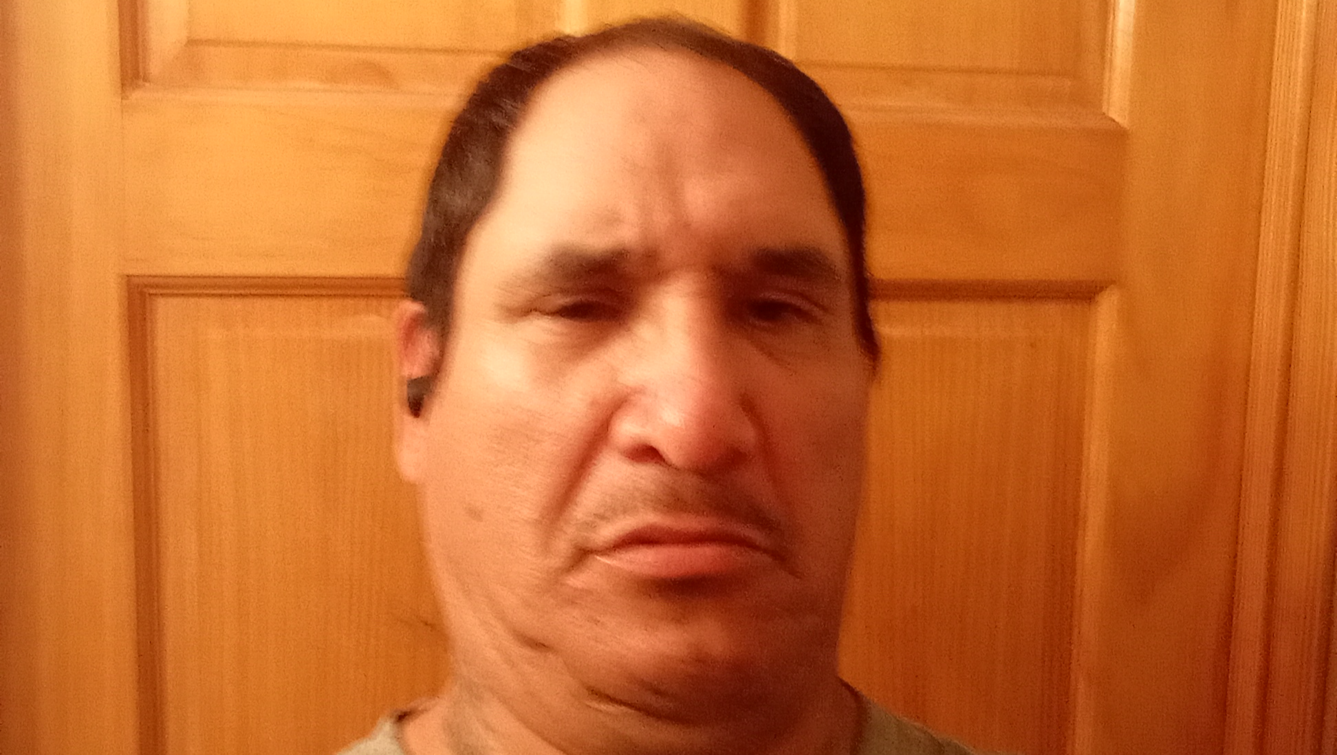 Support Joseph Simmons' Battle with Lupus photo
