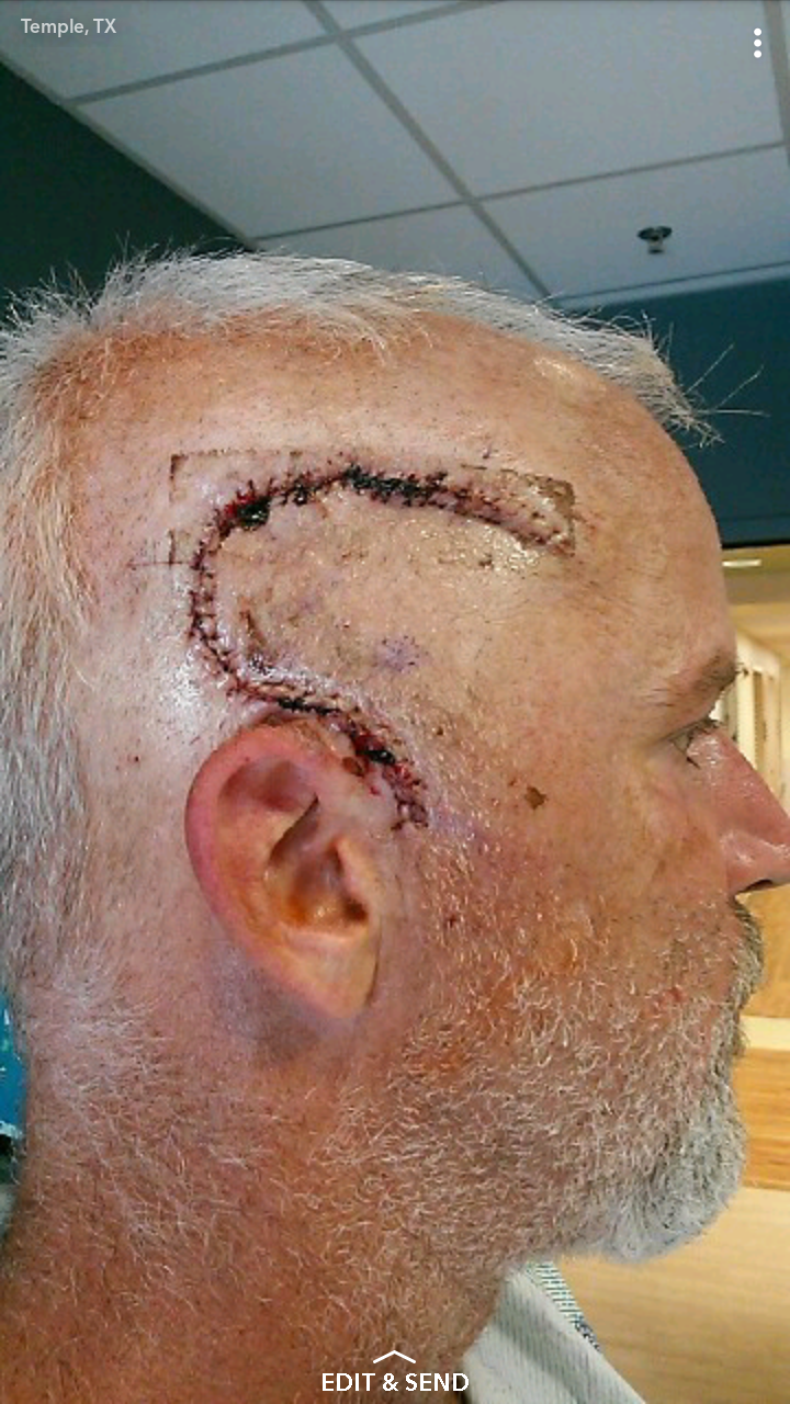 Support a Veteran's Battle Against Cancer campaign photo, 2 of 5