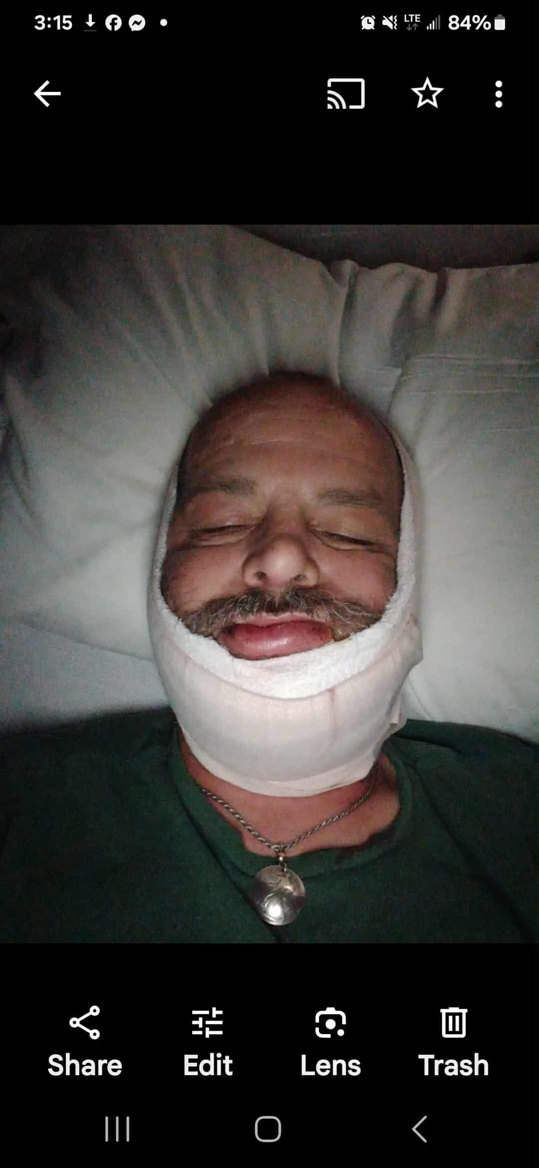 Support Mike Jones' Recovery Journey campaign photo, 4 of 5
