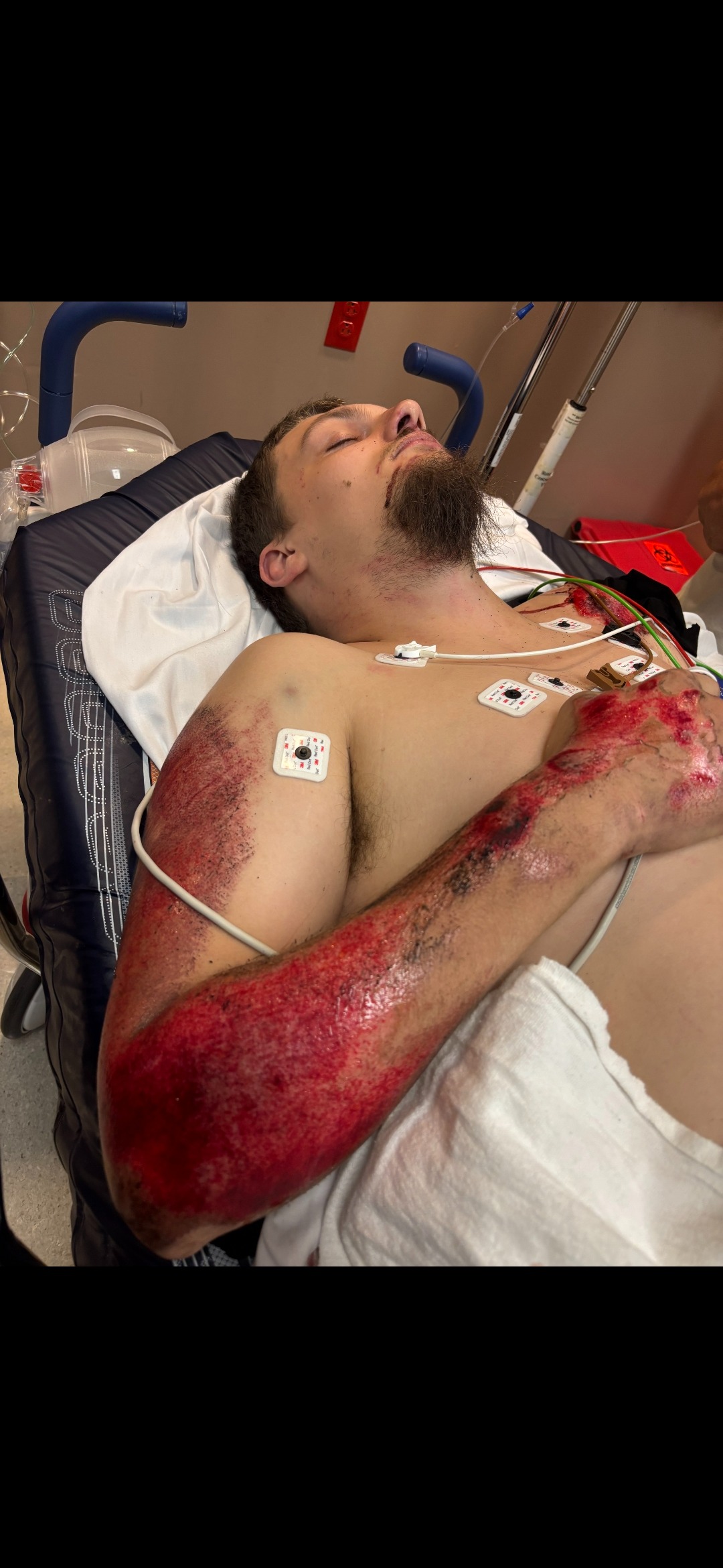 Support Korben's Long Road To Recovery campaign photo, 5 of 6