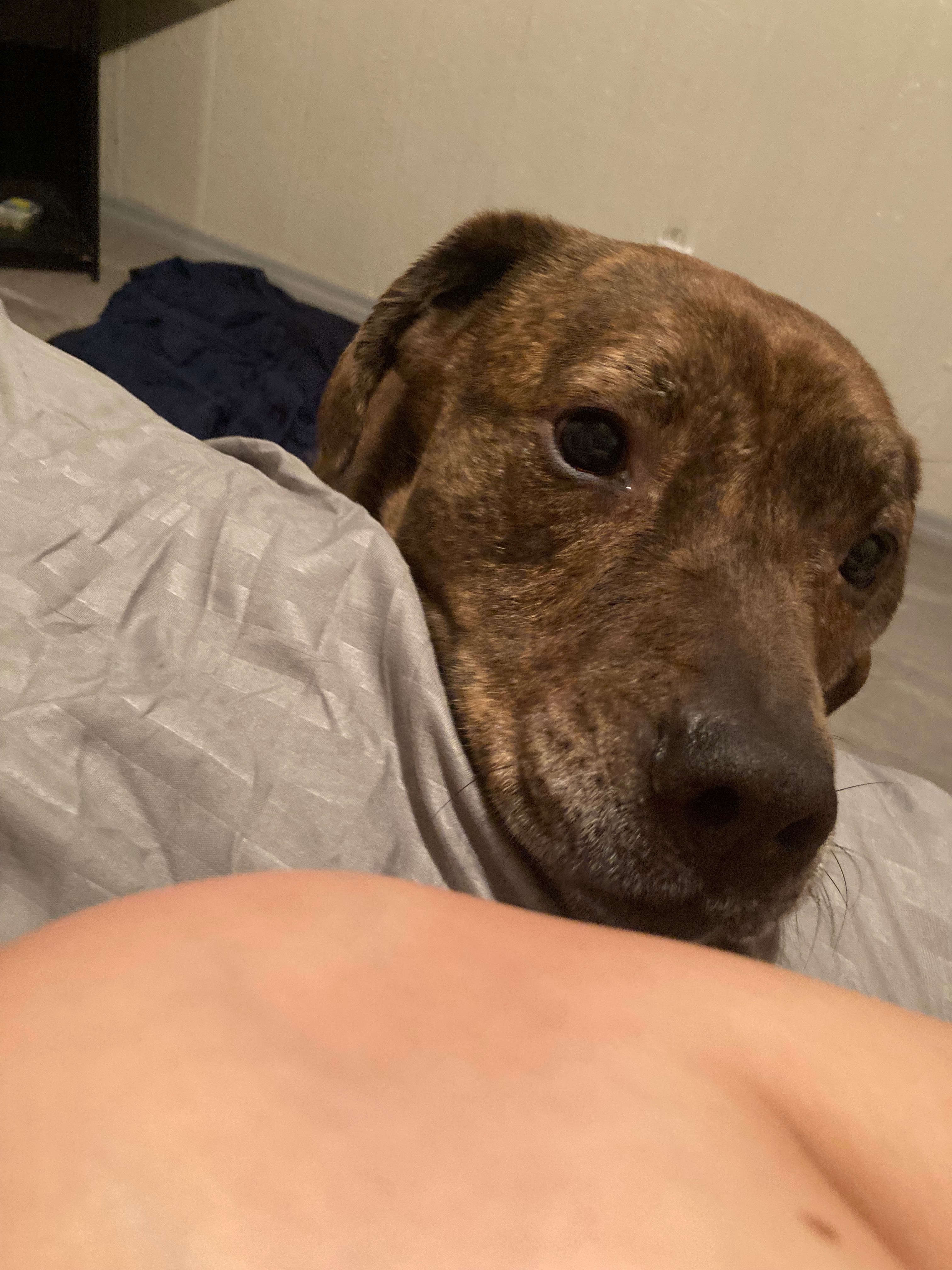 Help Save Leon’s Life – Our Sweet Rescue Dog Needs Surgery campaign photo, 6 of 8