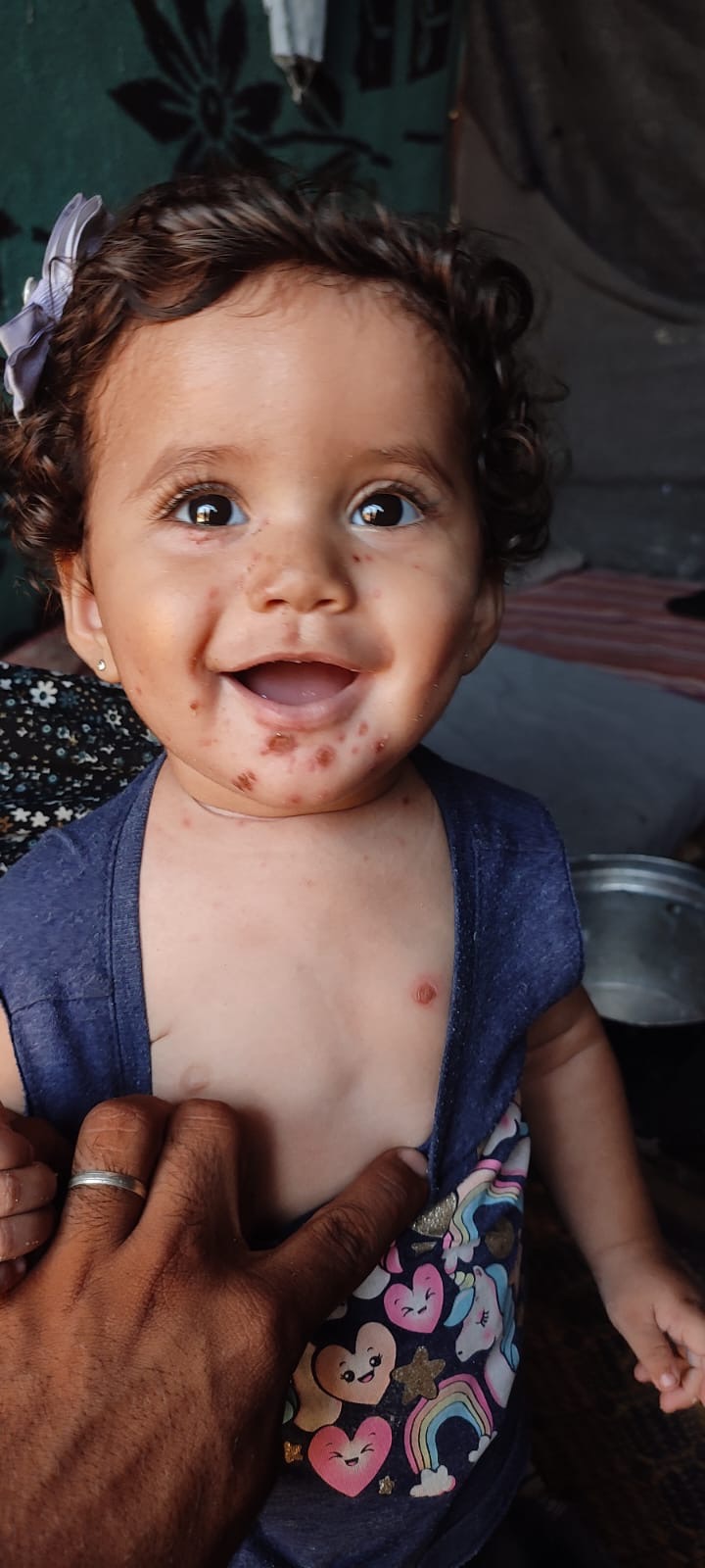 Help Mimi Escape Gaza for Life-Saving Care campaign photo, 2 of 6
